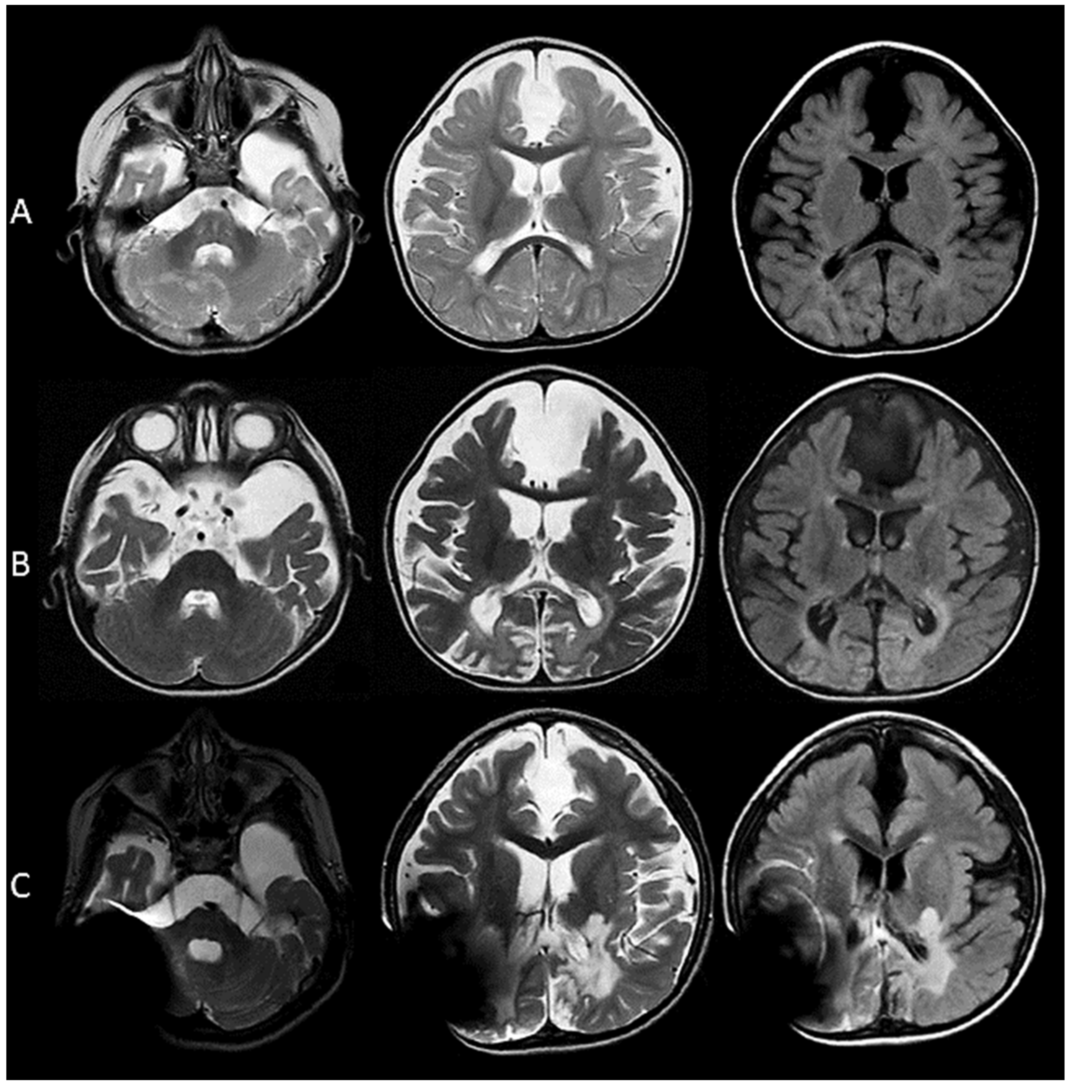 Genes 11 01437 g001 Genes 11 01437 g001