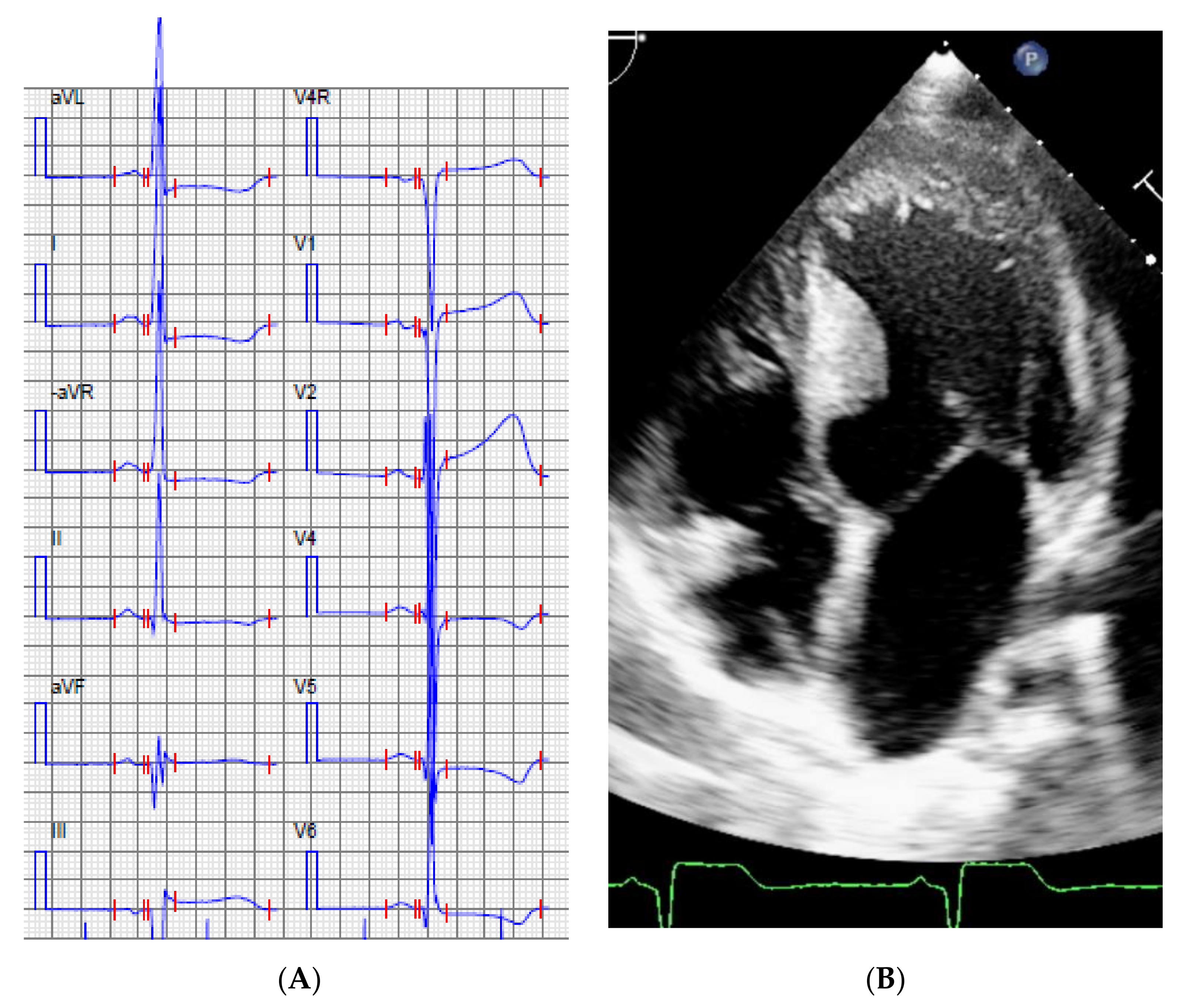 Genes 11 01472 g003 Genes 11 01472 g003