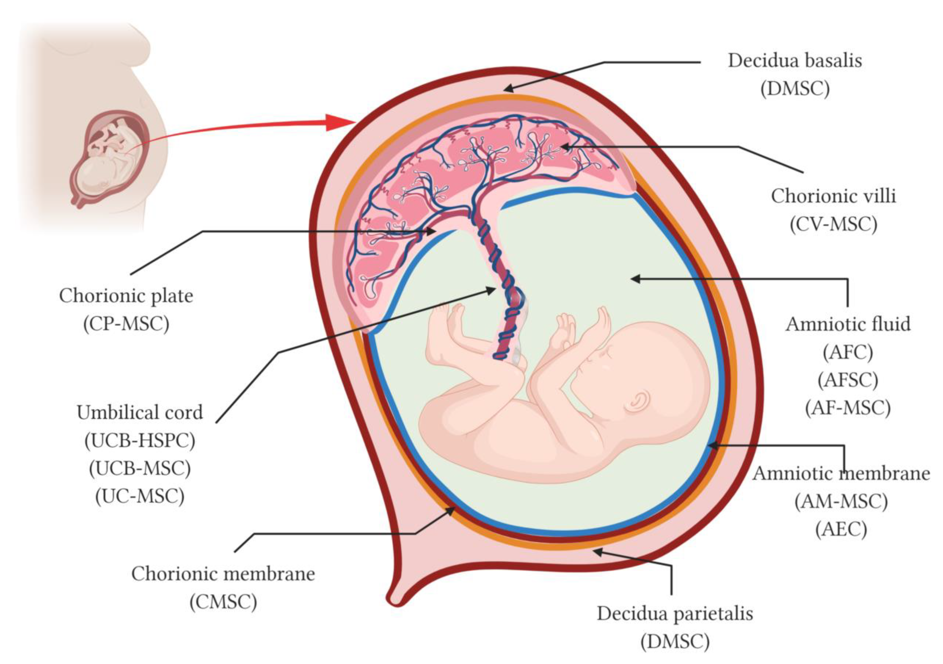 Amniotic Band Syndrome (Streeter Dysplasia): Causes, Signs & Treatment