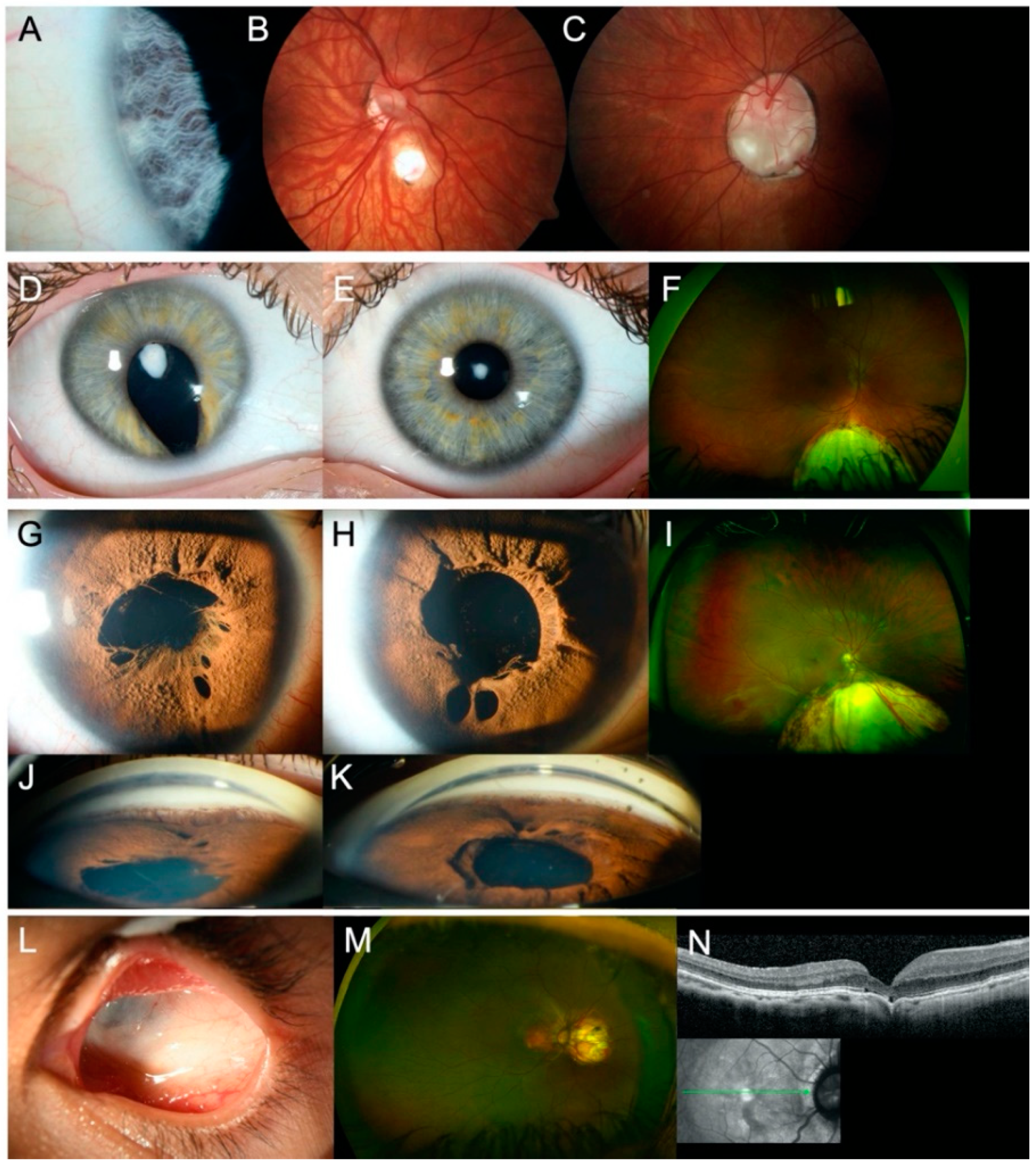 Genes 12 00065 g003 Genes 12 00065 g003