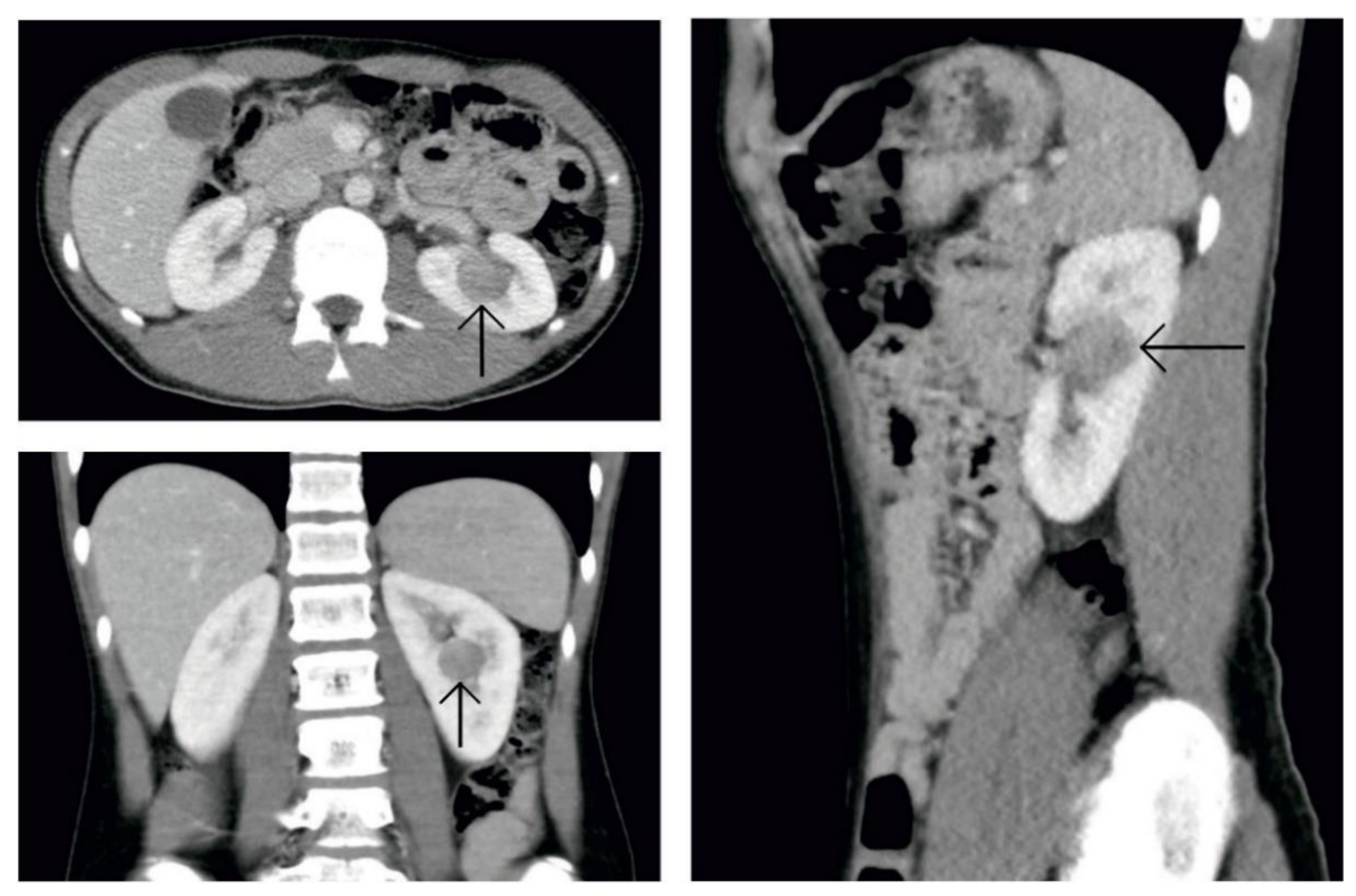 Genes 12 00220 g002 Genes 12 00220 g002