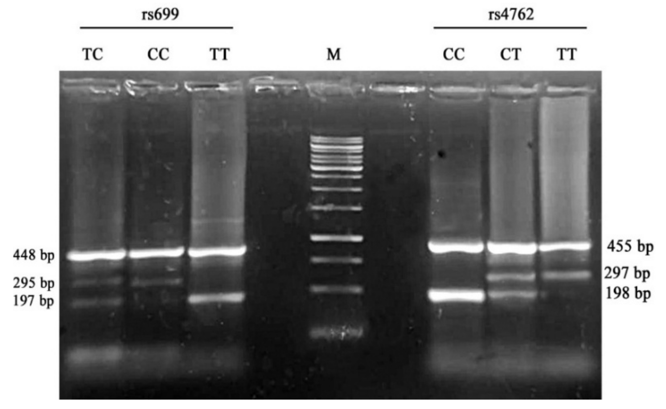 Genes 12 00339 g001