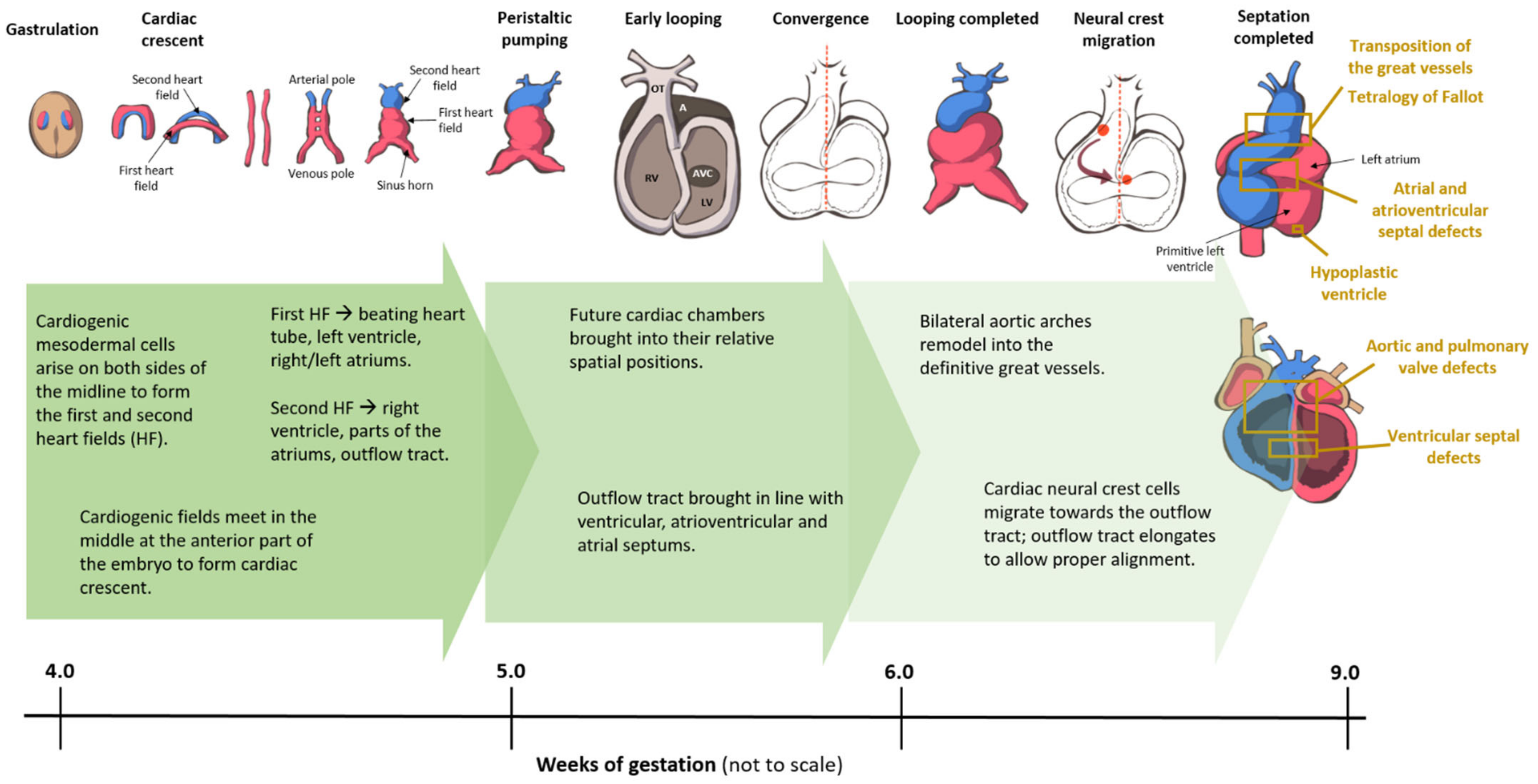 A Case of Rubinstein-Taybi Syndrome with Tetralogy of Fallot