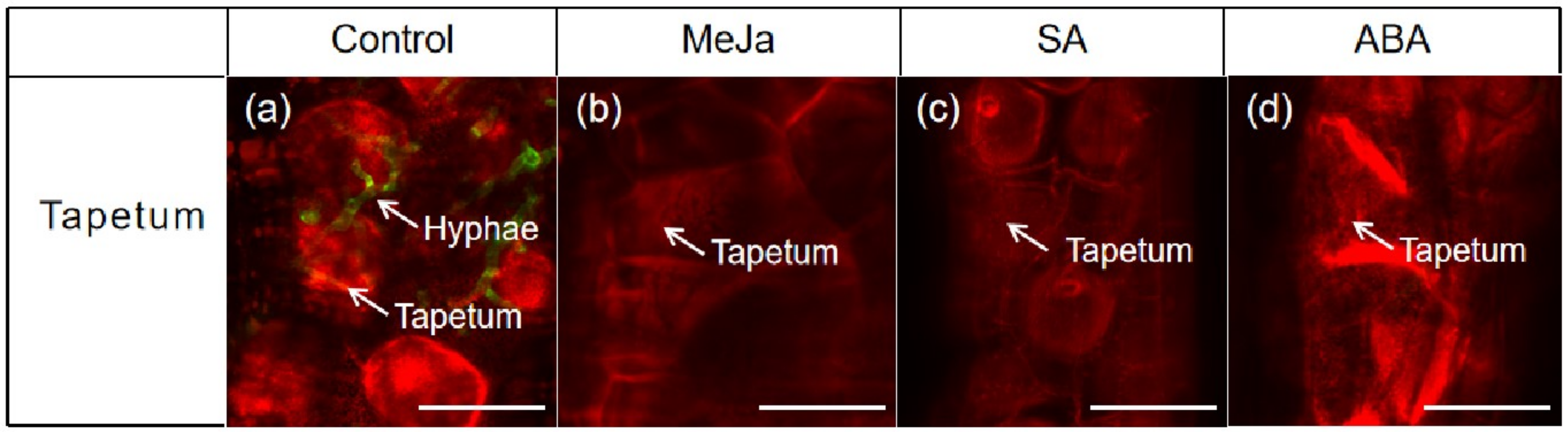 Genes 12 00425 g005 Genes 12 00425 g005