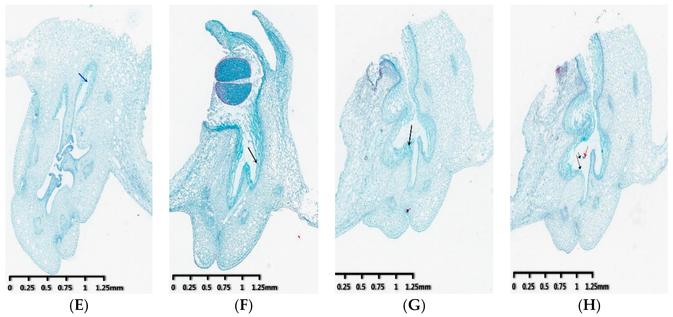 Genes 12 00432 g001b