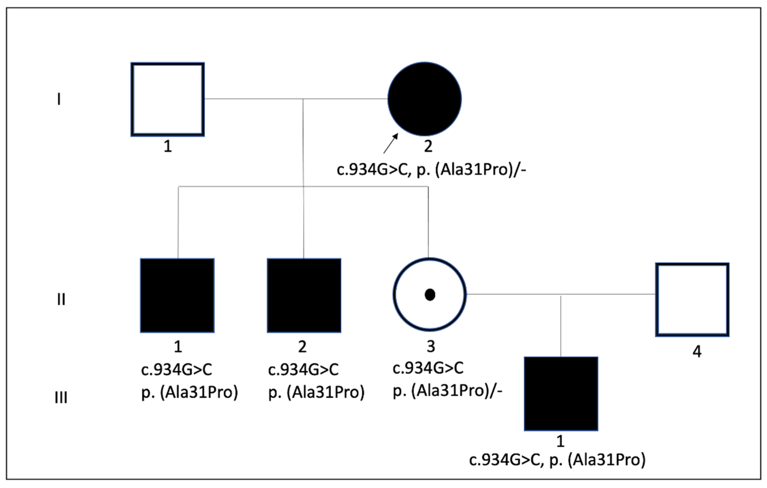 Genes Free Full Text A New Pathogenic Variant In Pou3f4 Causing Deafness Due To An Incomplete Partition Of The Cochlea Paved The Way For Innovative Surgery Html