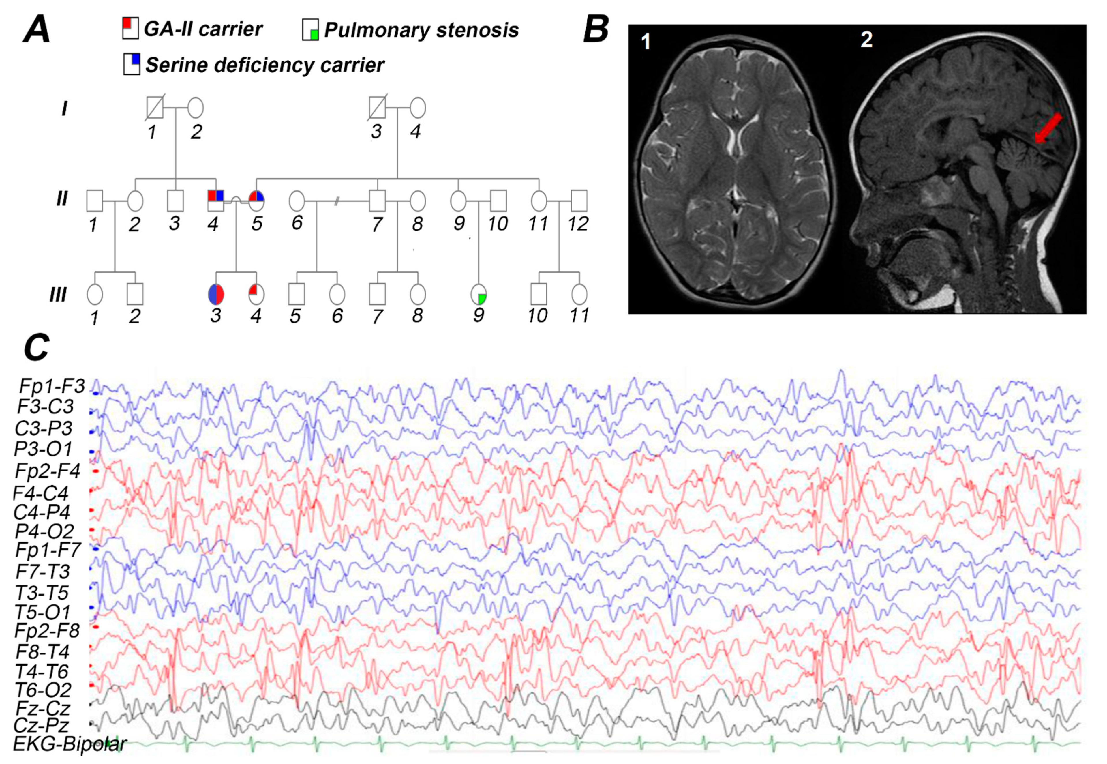 Genes 12 00703 g001 Genes 12 00703 g001