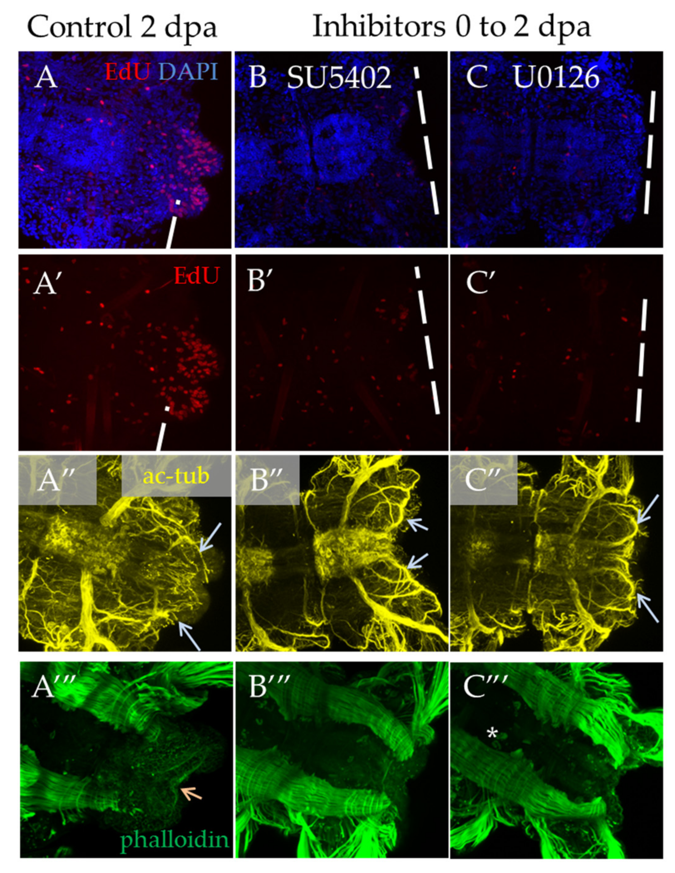 Genes 12 00788 g007