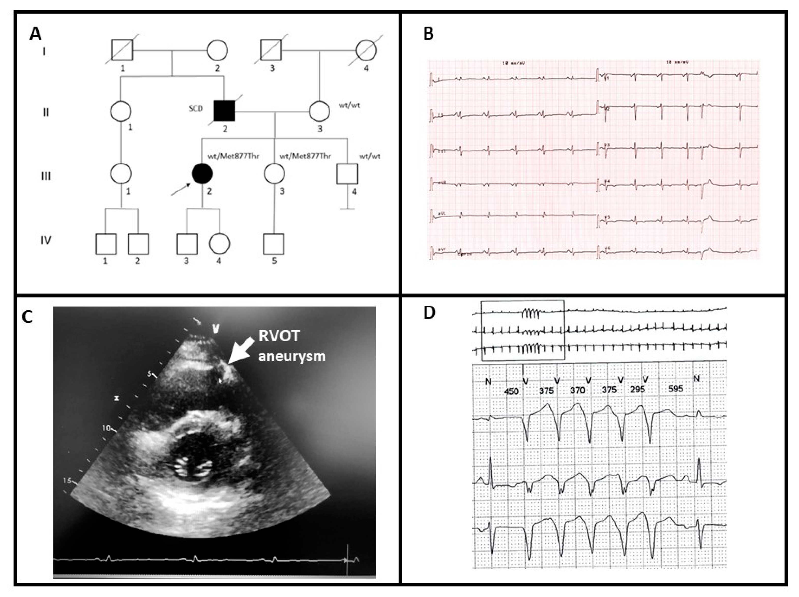 Genes 12 00793 g001 Genes 12 00793 g001