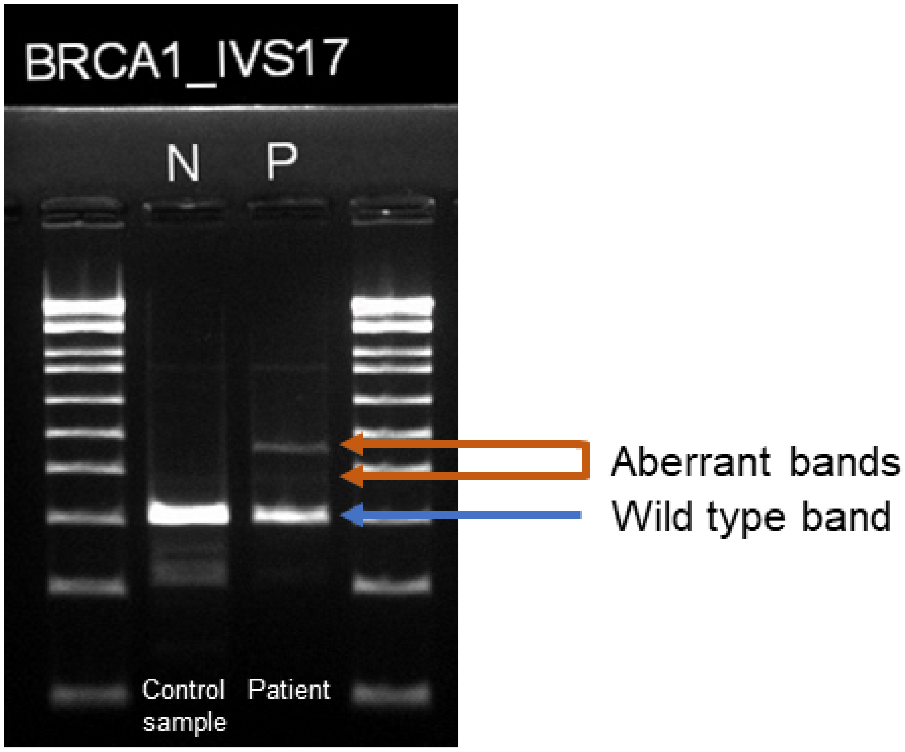 Genes 12 00810 g002 Genes 12 00810 g002