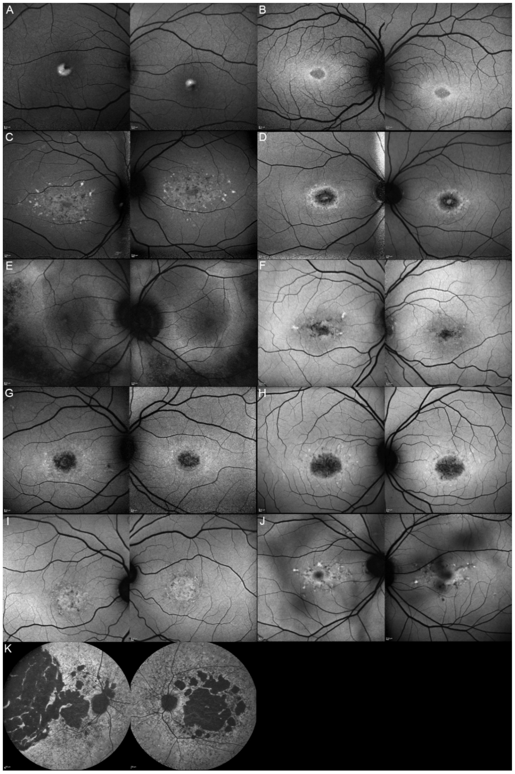 Genes 12 00812 g003 Genes 12 00812 g003