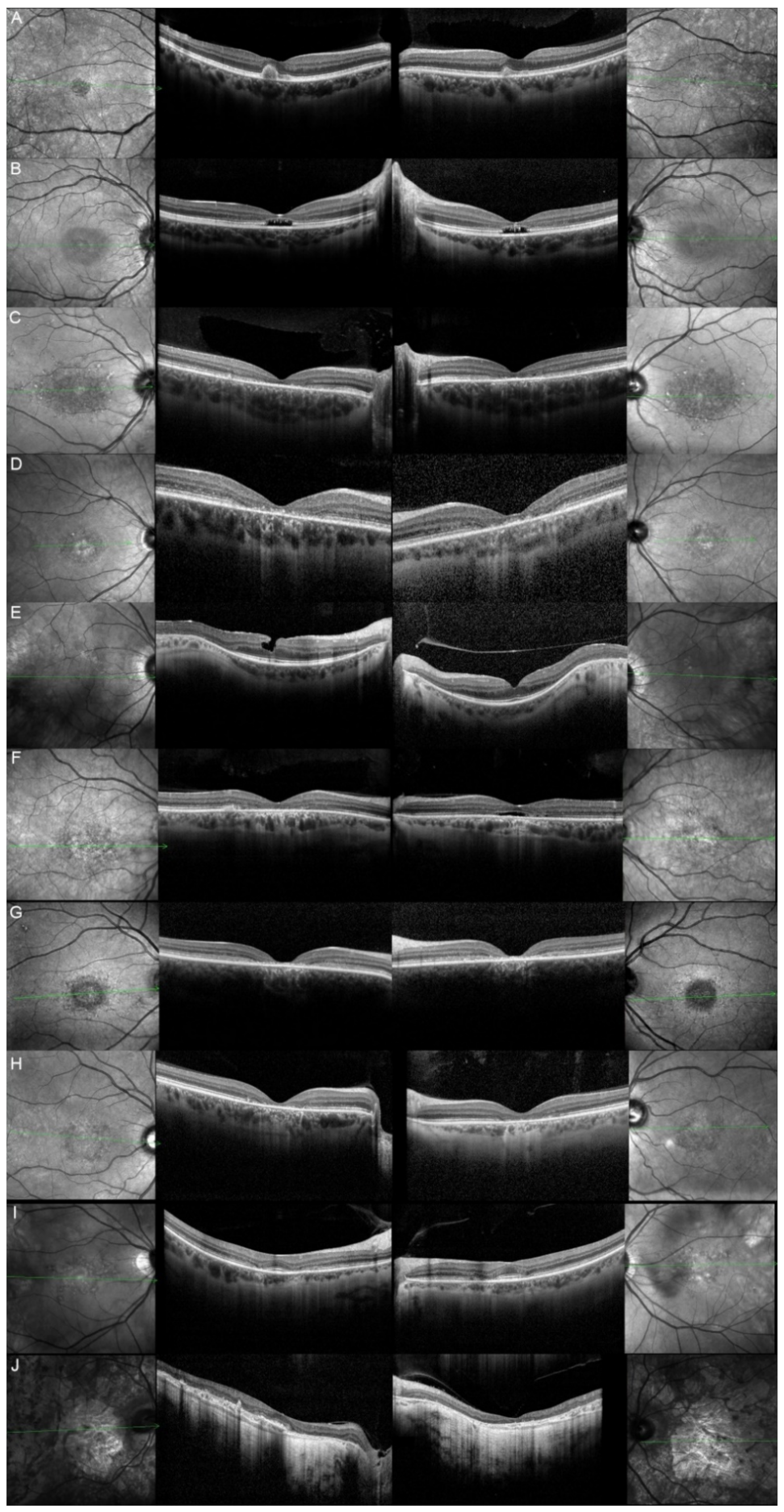 Genes 12 00812 g004 Genes 12 00812 g004