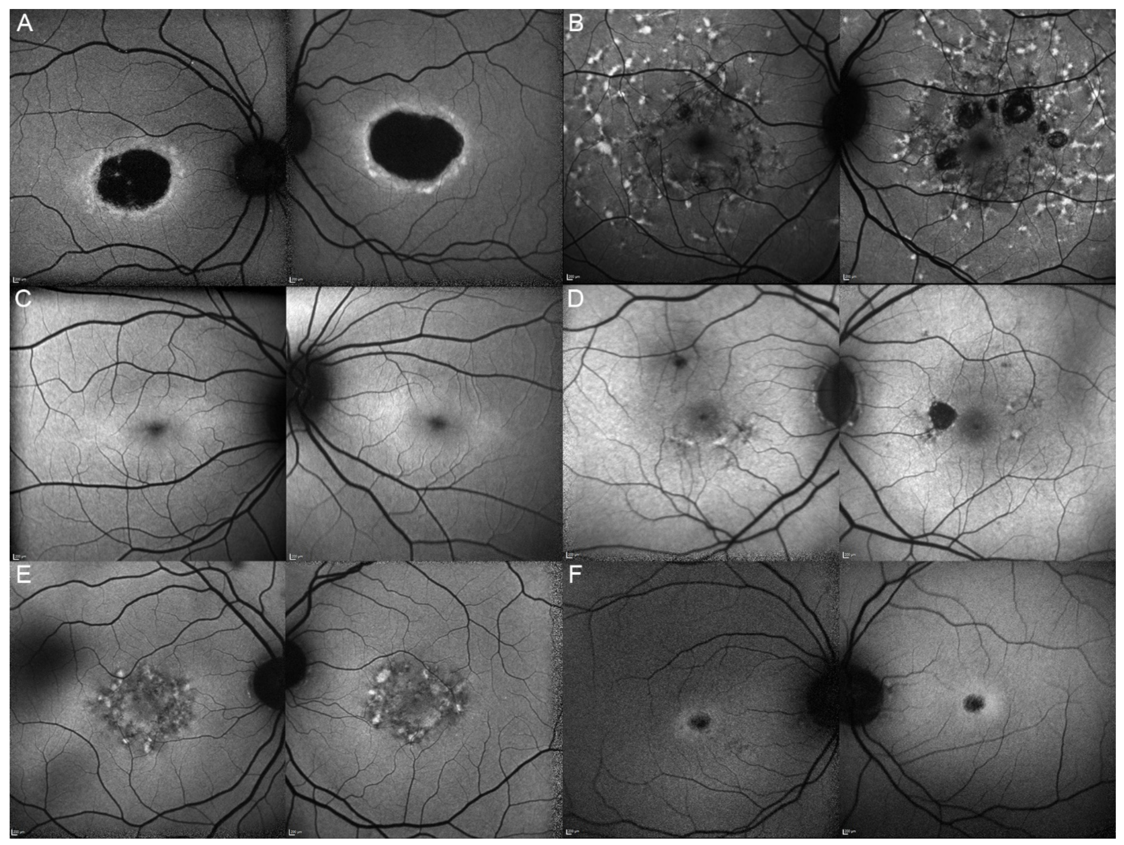 Genes 12 00812 g007 Genes 12 00812 g007