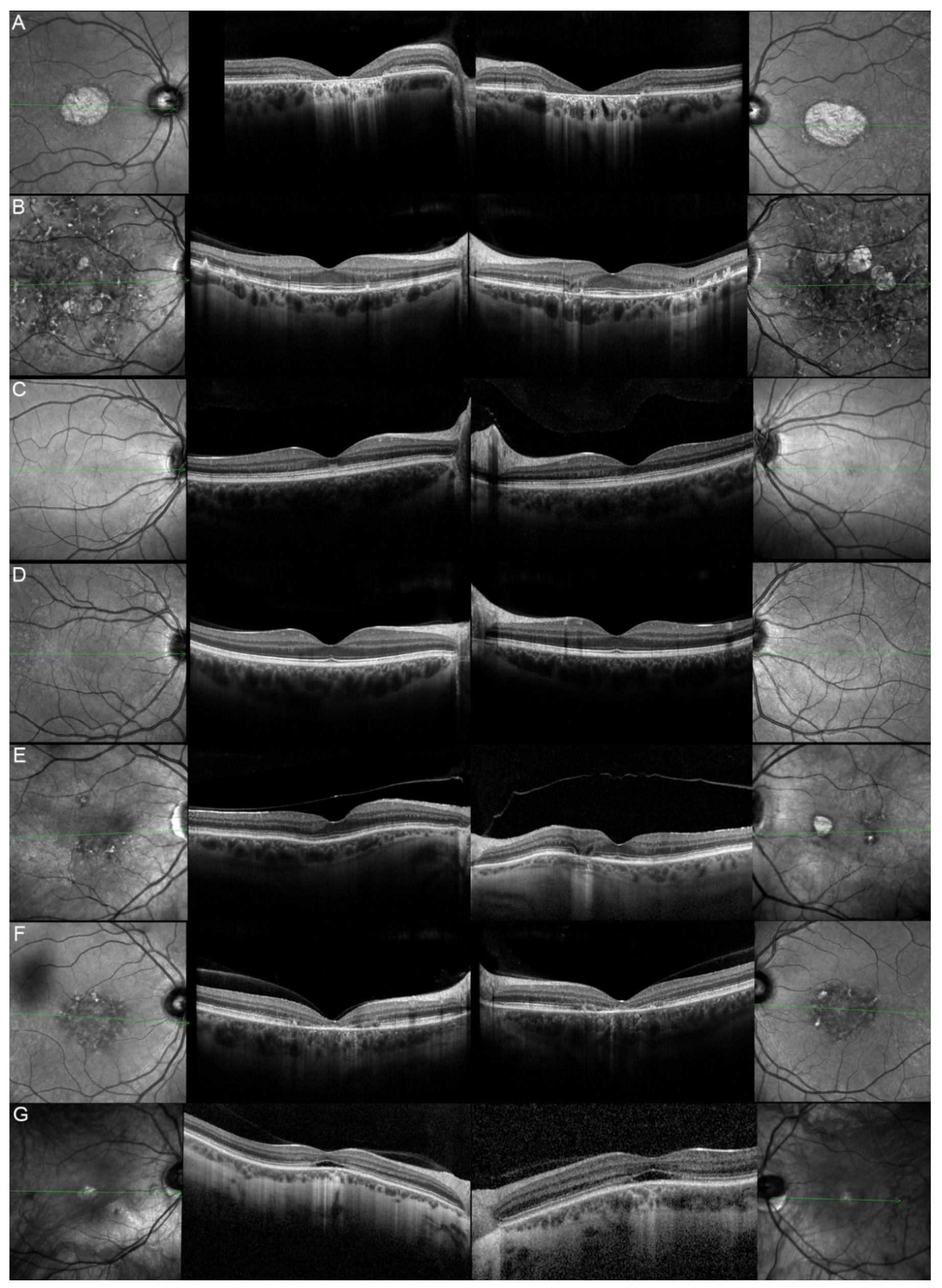 Genes 12 00812 g008 Genes 12 00812 g008