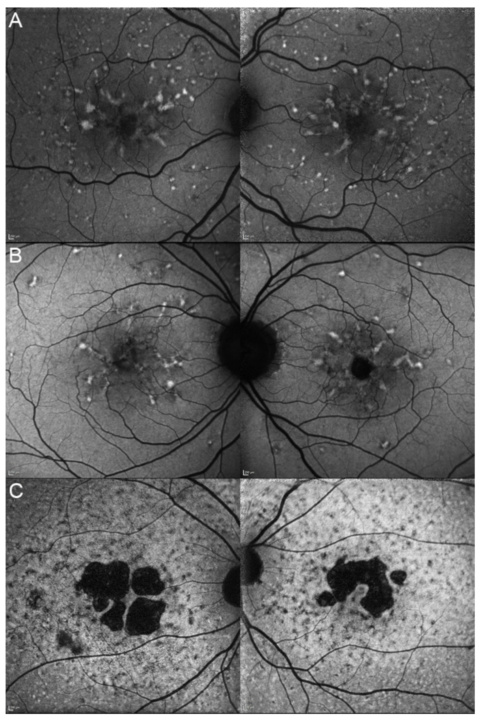 Genes 12 00812 g011 Genes 12 00812 g011