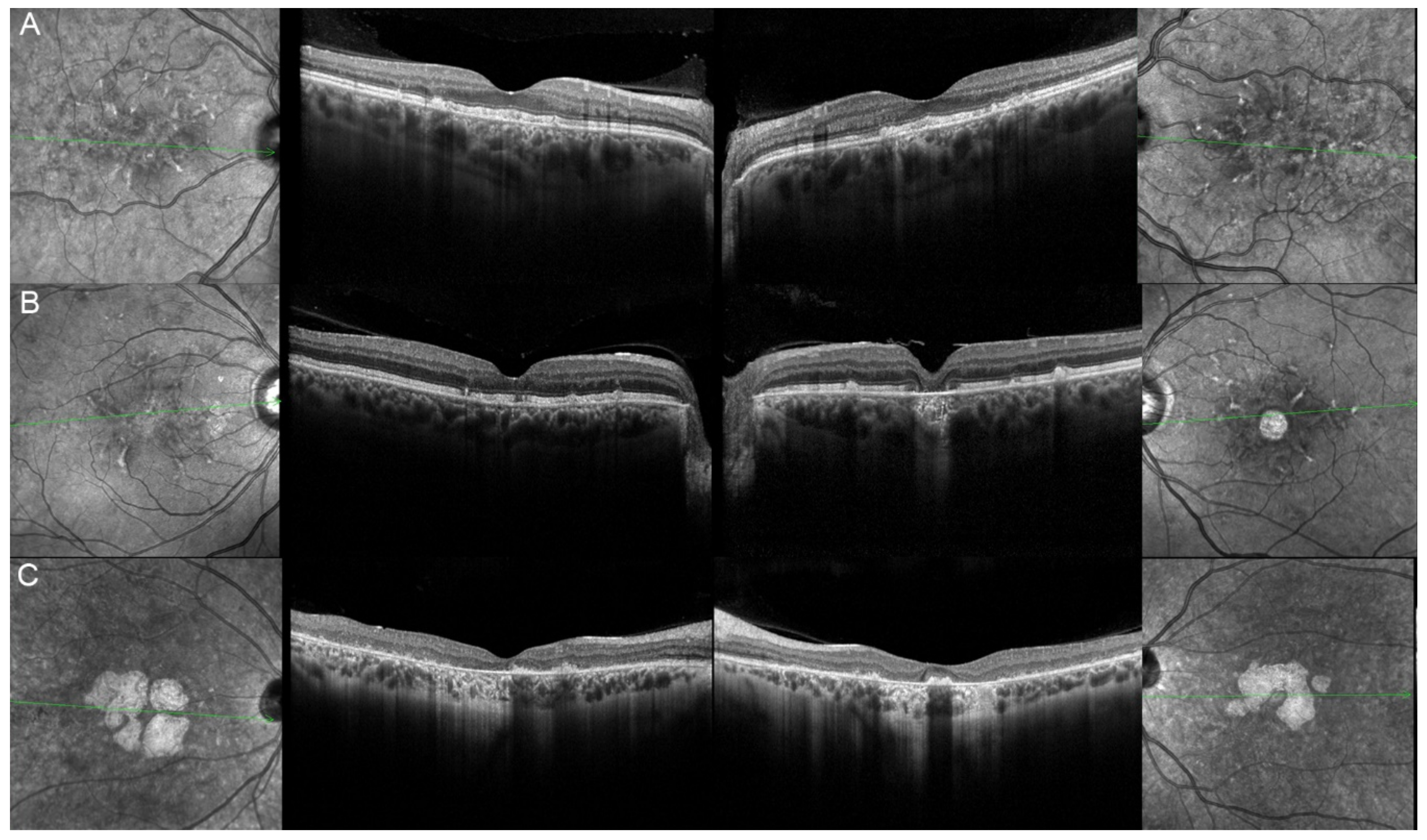 Genes 12 00812 g012 Genes 12 00812 g012