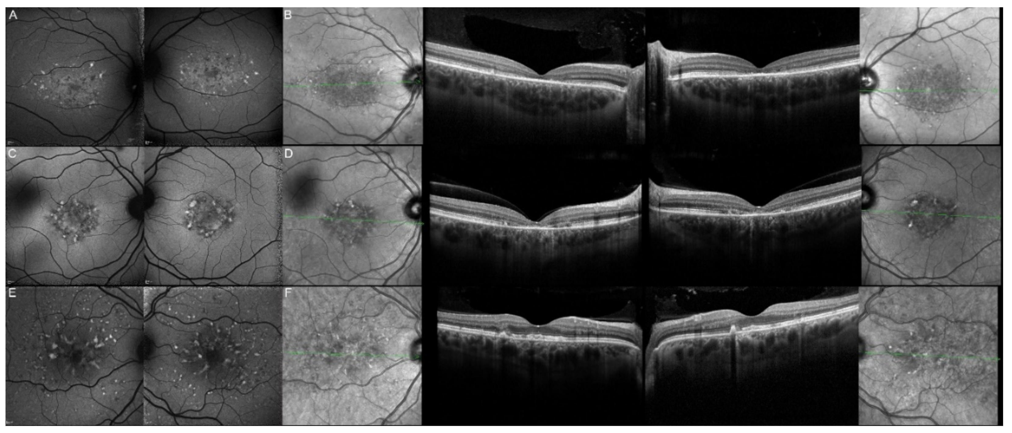 Genes 12 00812 g013 Genes 12 00812 g013