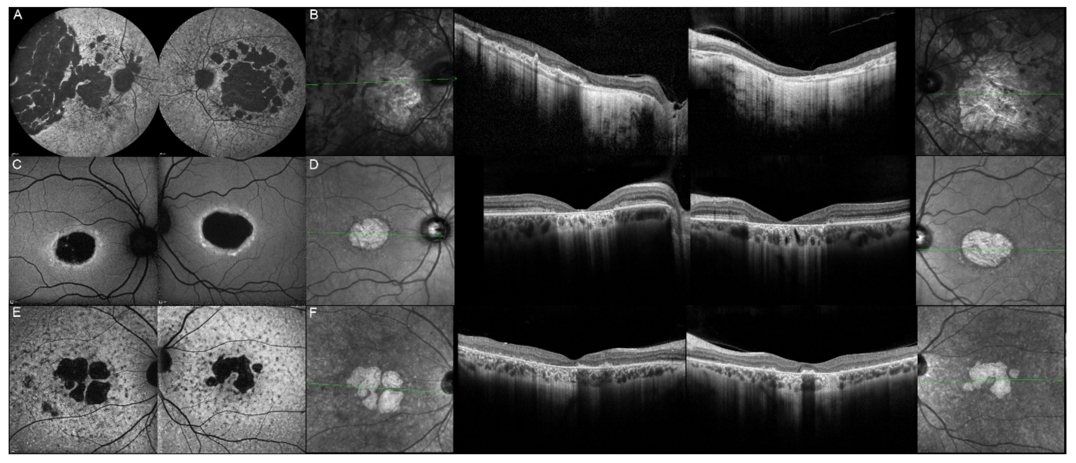 Genes 12 00812 g014 Genes 12 00812 g014