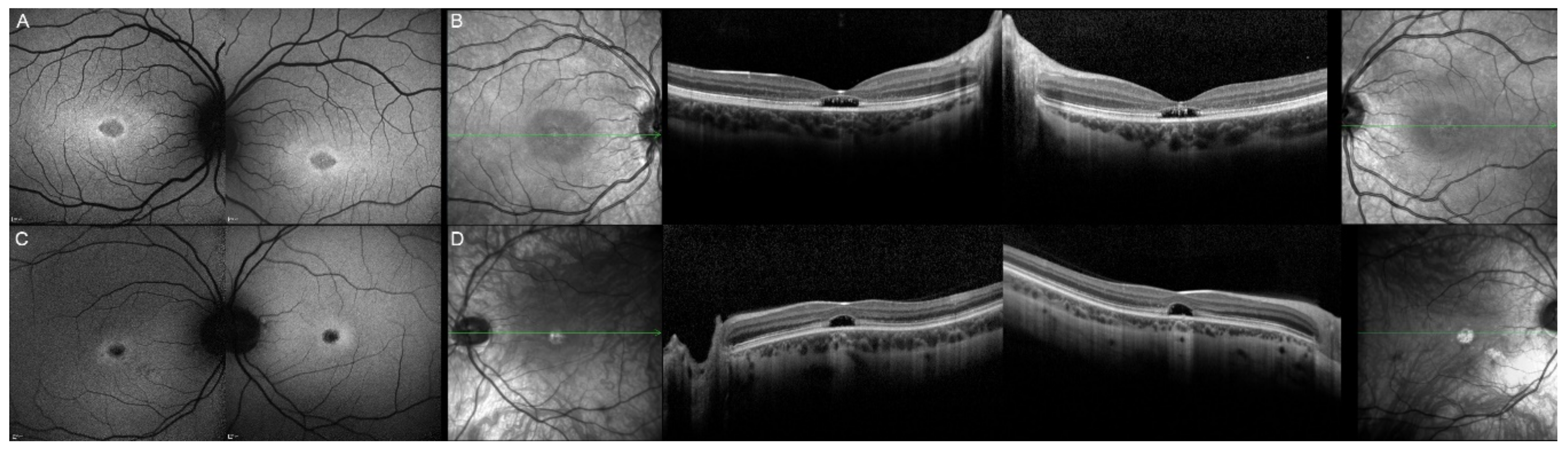 Genes 12 00812 g015 Genes 12 00812 g015