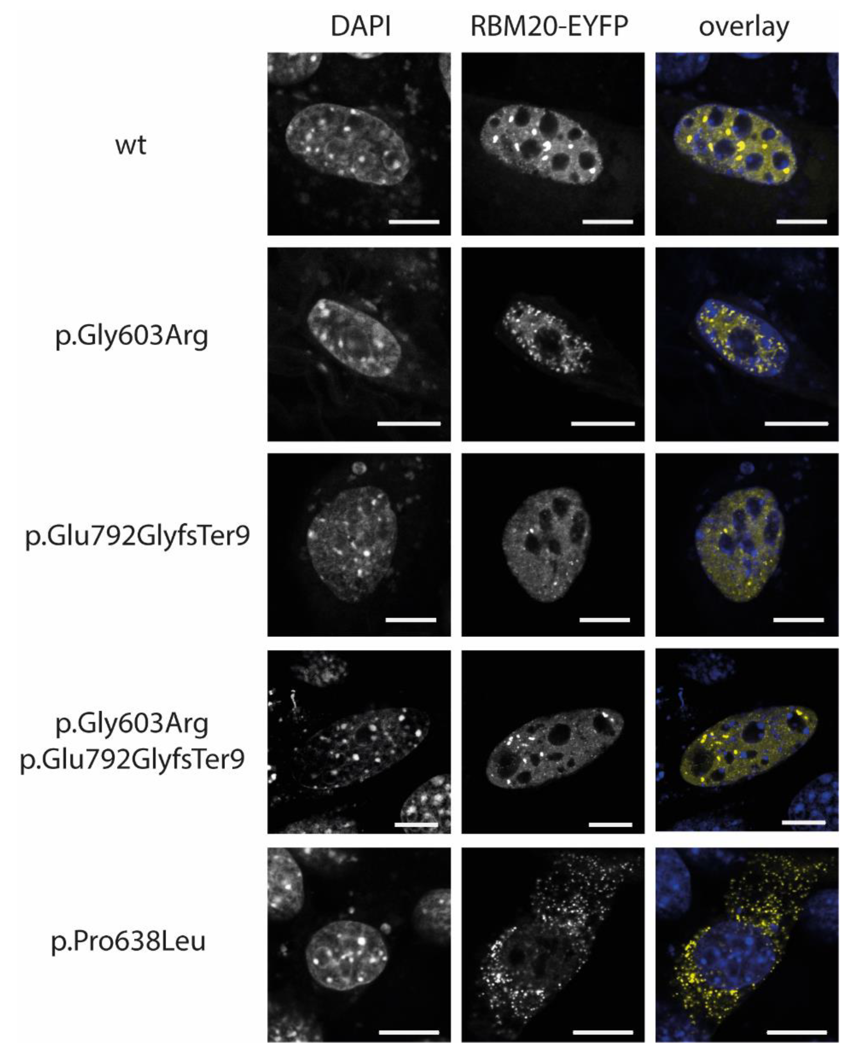 Genes 12 00883 g003 Genes 12 00883 g003