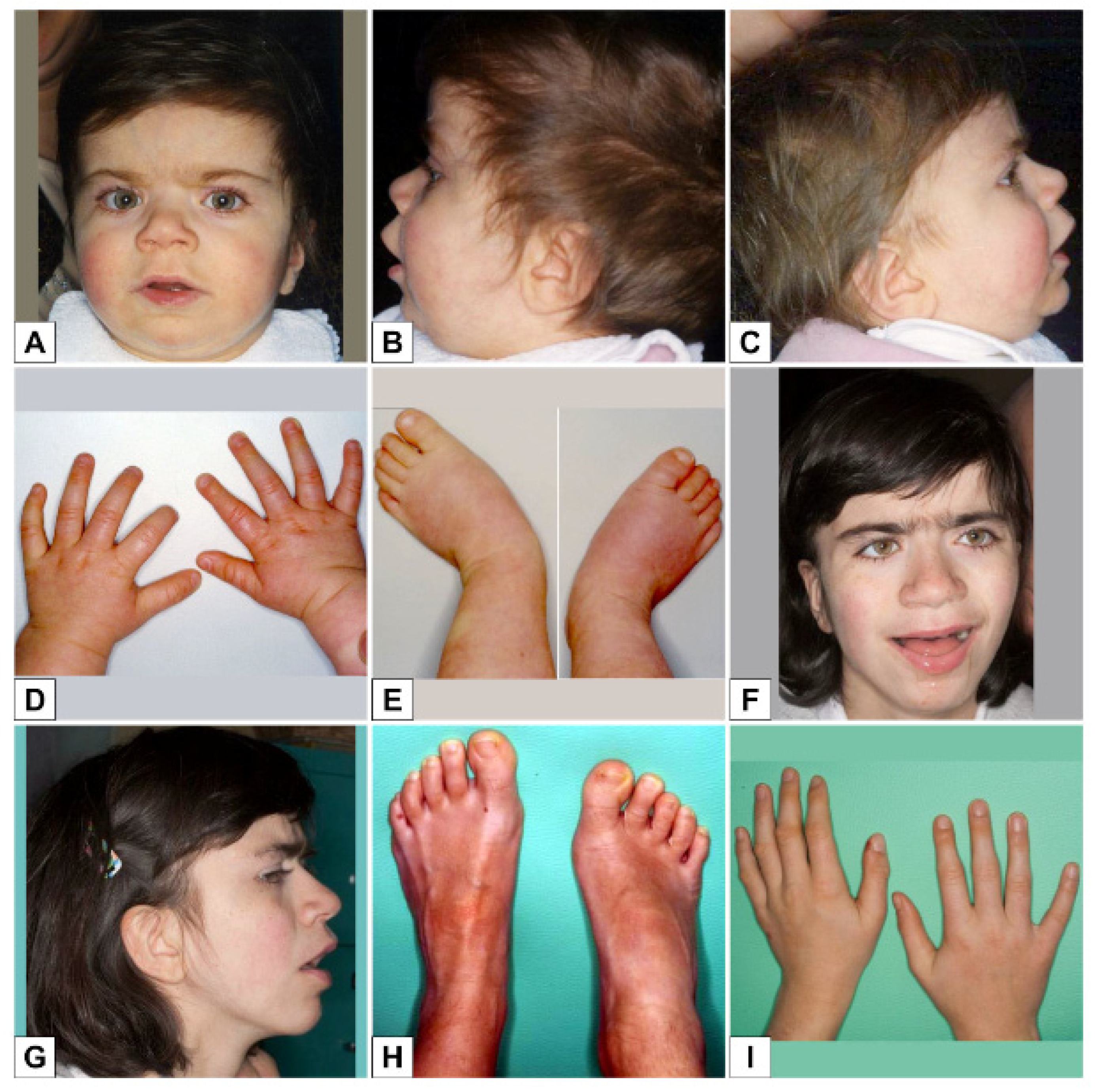 Genes 12 00900 g001 Genes 12 00900 g001