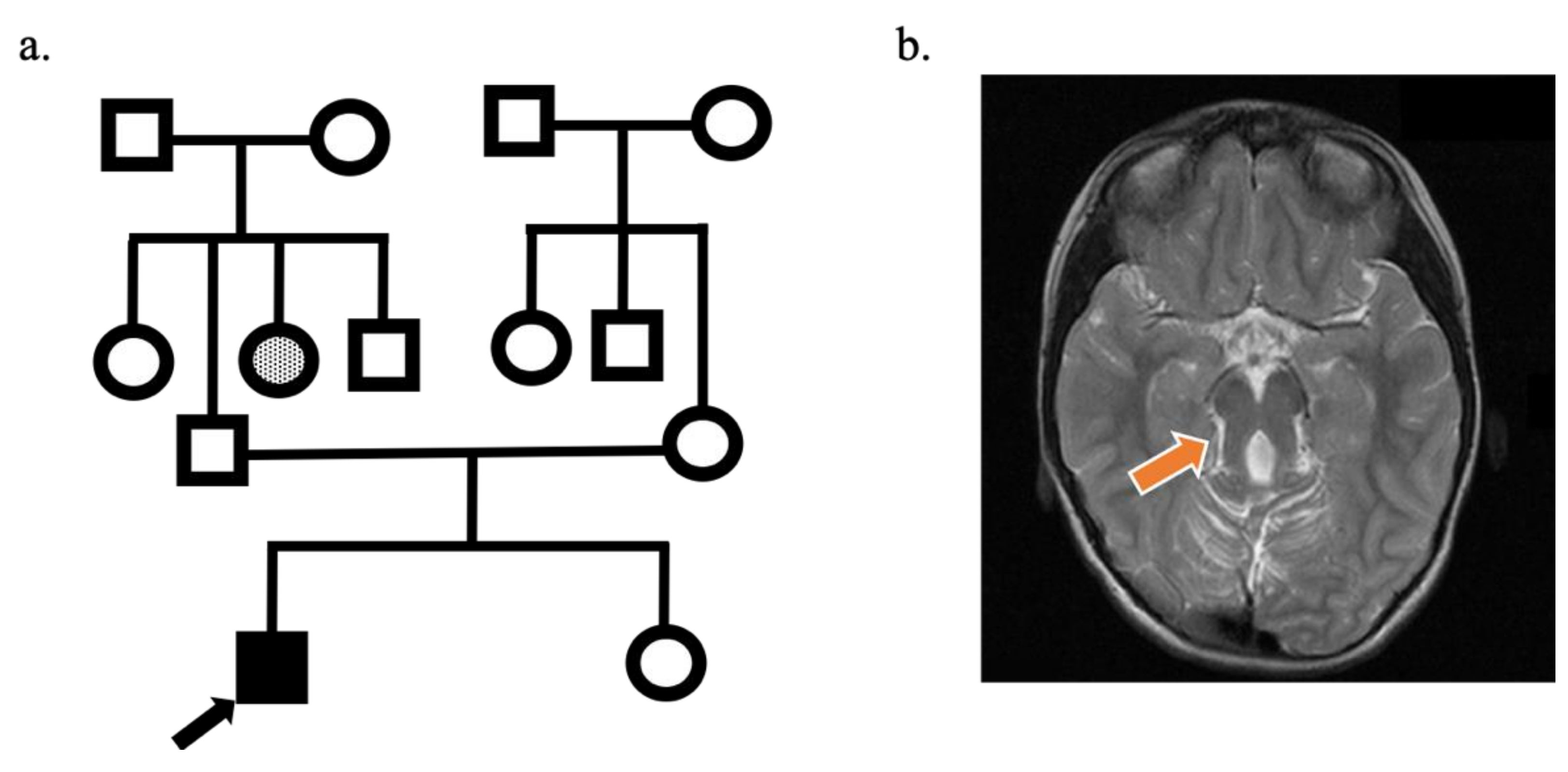 Genes 12 00945 g001
