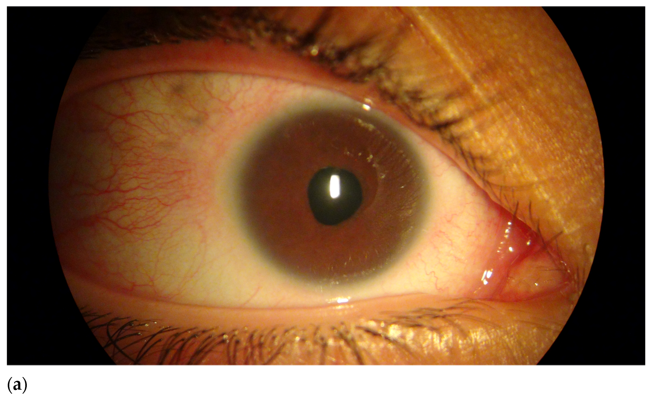 Genes 12 01069 g001a