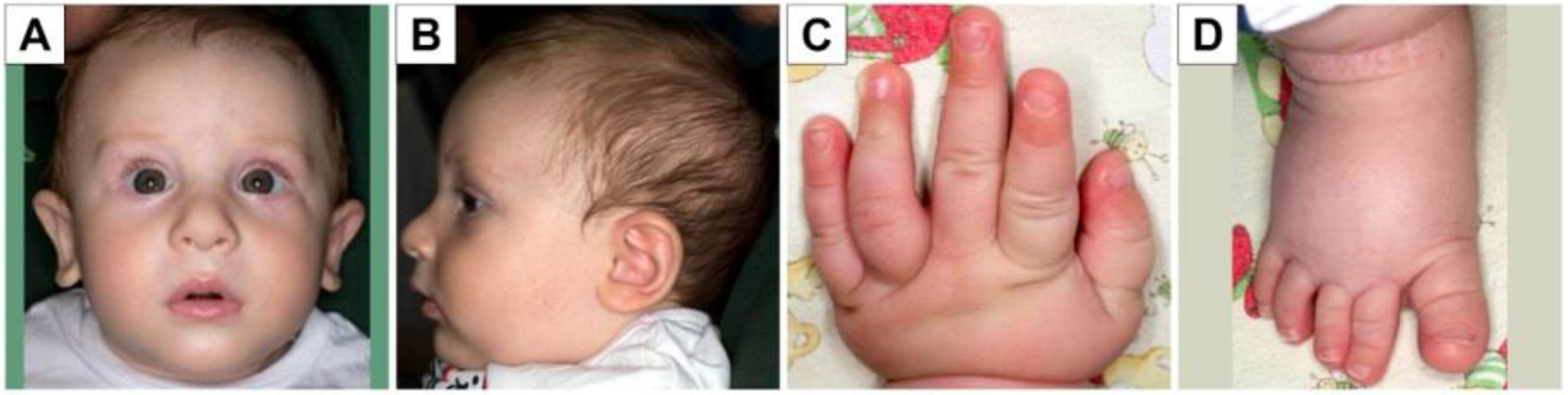 Genes 12 01208 g001