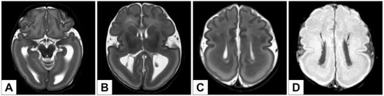 Genes 12 01208 g002 550
