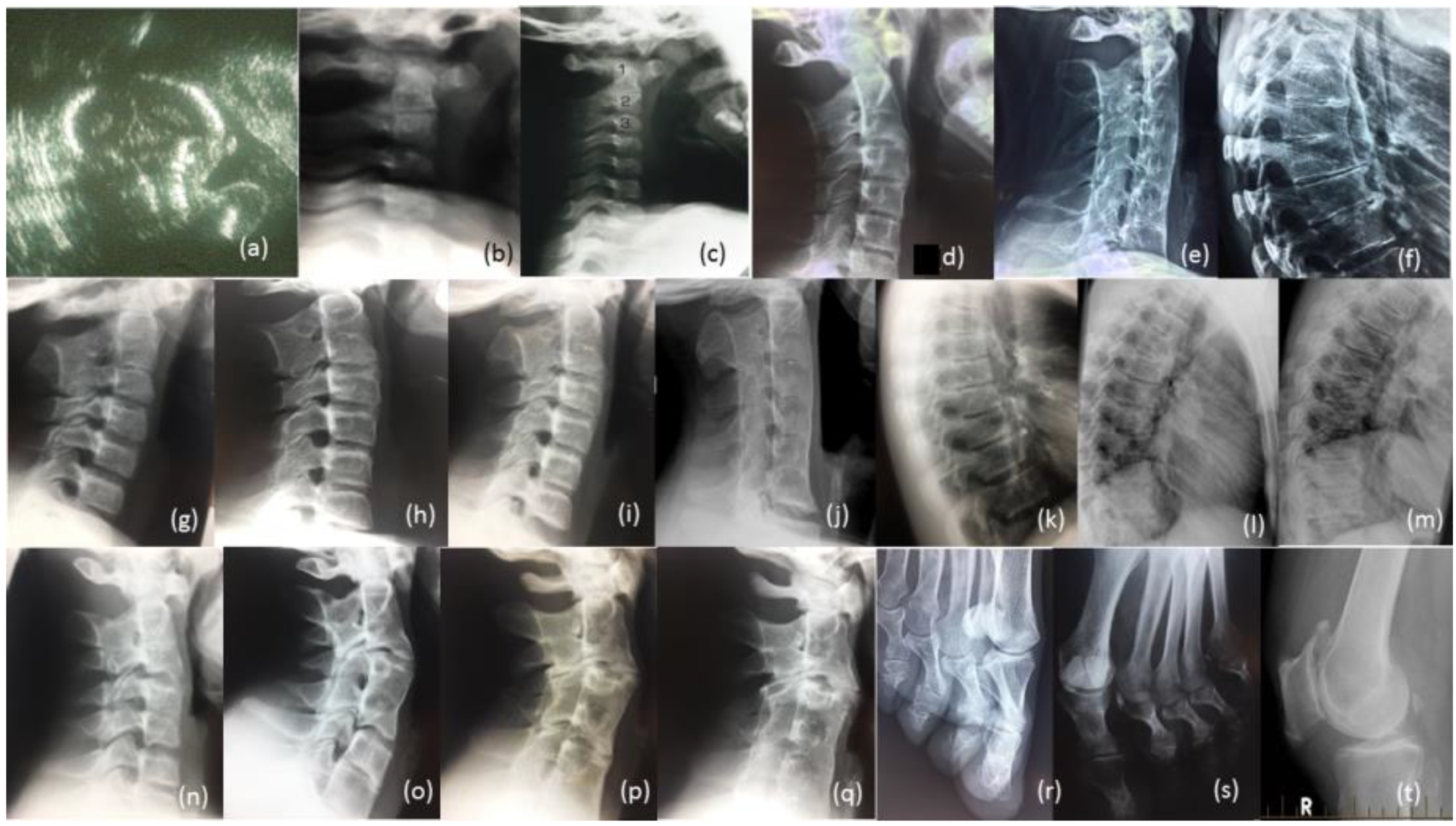 Genes 12 01354 g004 Genes 12 01354 g004