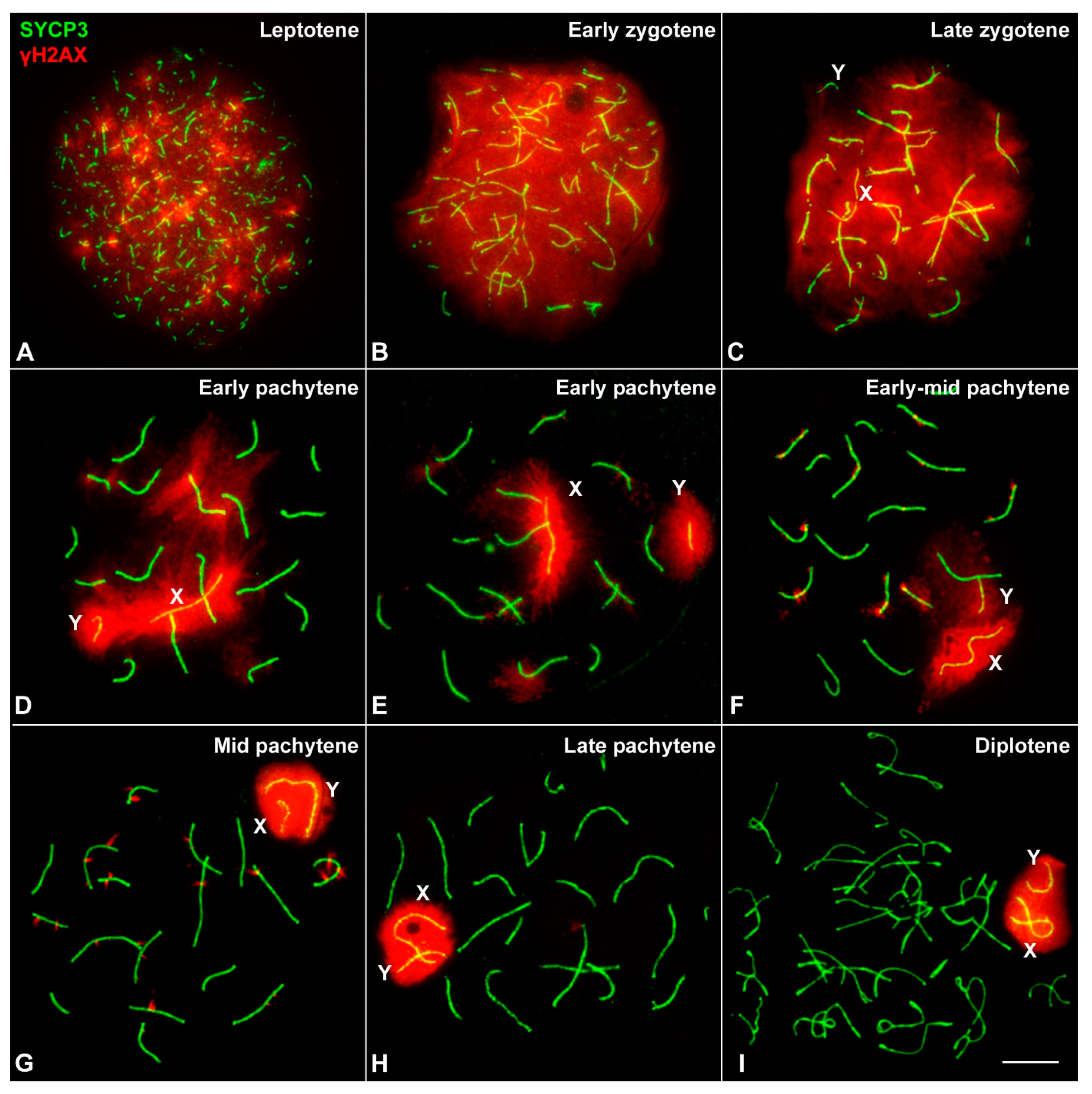 Genes Free Full Text Meiotic Behavior Of Achiasmate Sex Chromosomes In The African Pygmy Mouse Mus Mattheyi Offers New Insights Into The Evolution Of Sex Chromosome Pairing And Segregation In Mammals