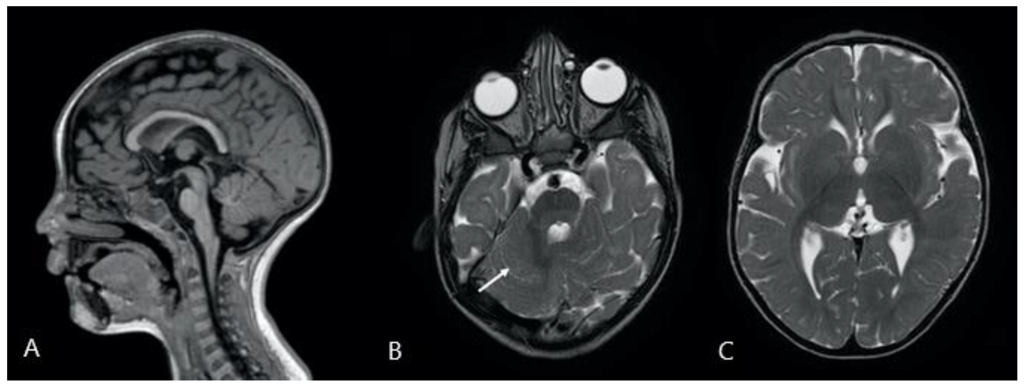 Genes 12 01513 g002 Genes 12 01513 g002