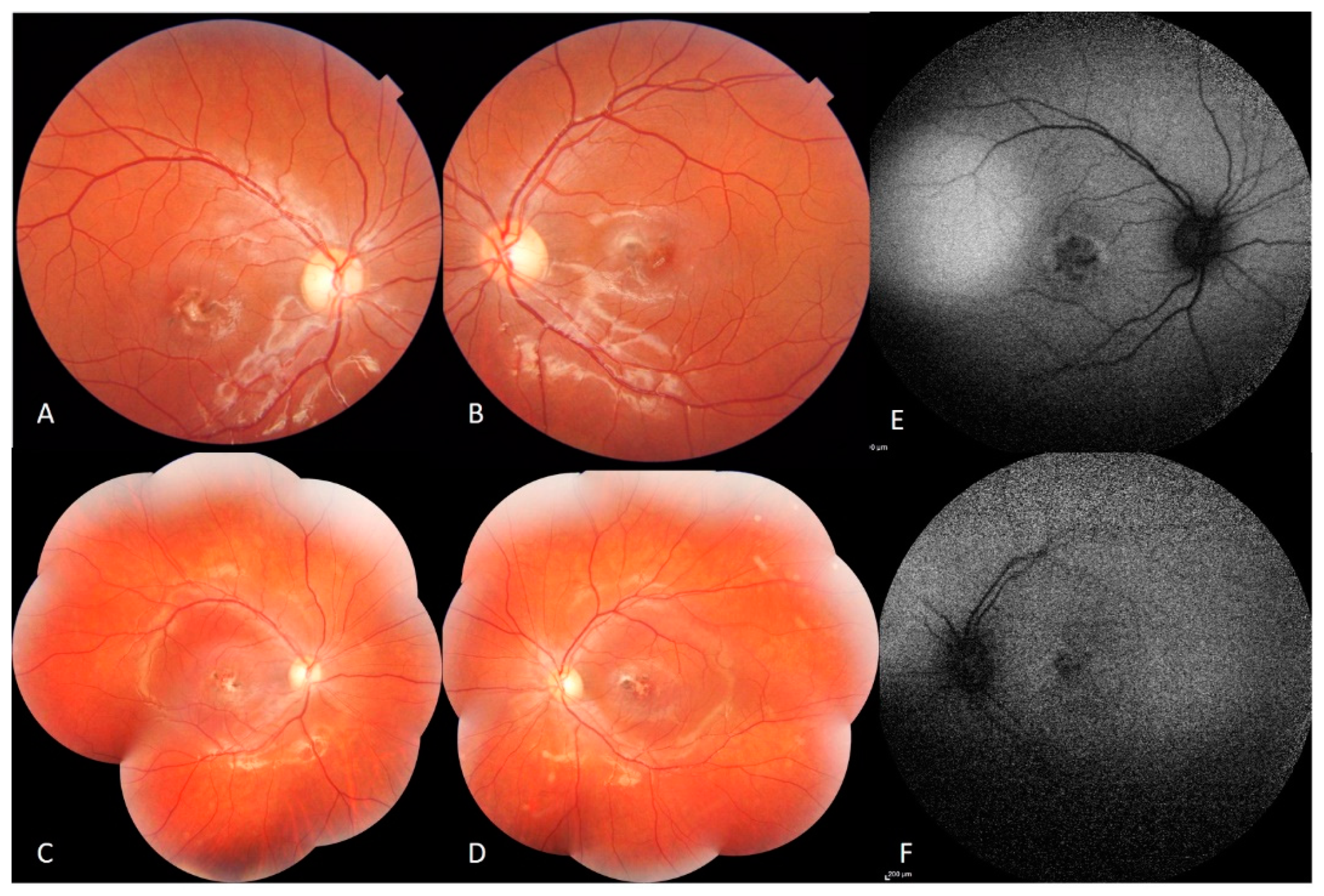 Genes 12 01795 g001 550