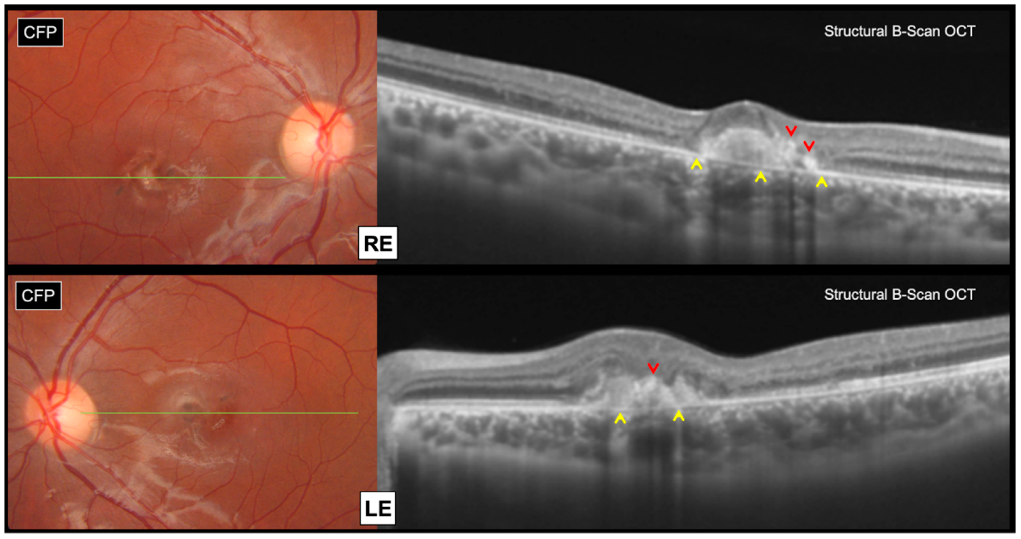 Genes 12 01795 g002 550