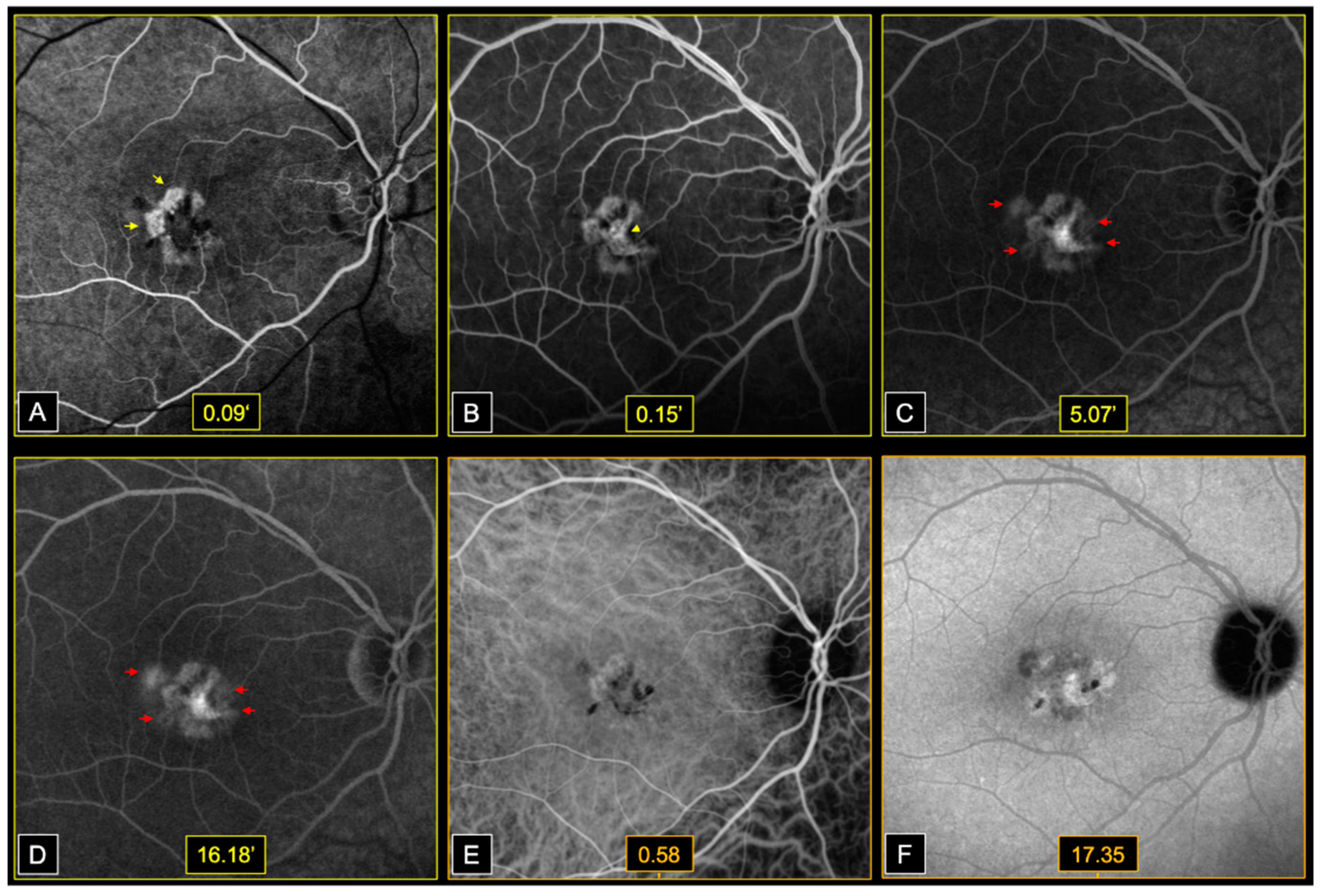 Genes 12 01795 g003 550
