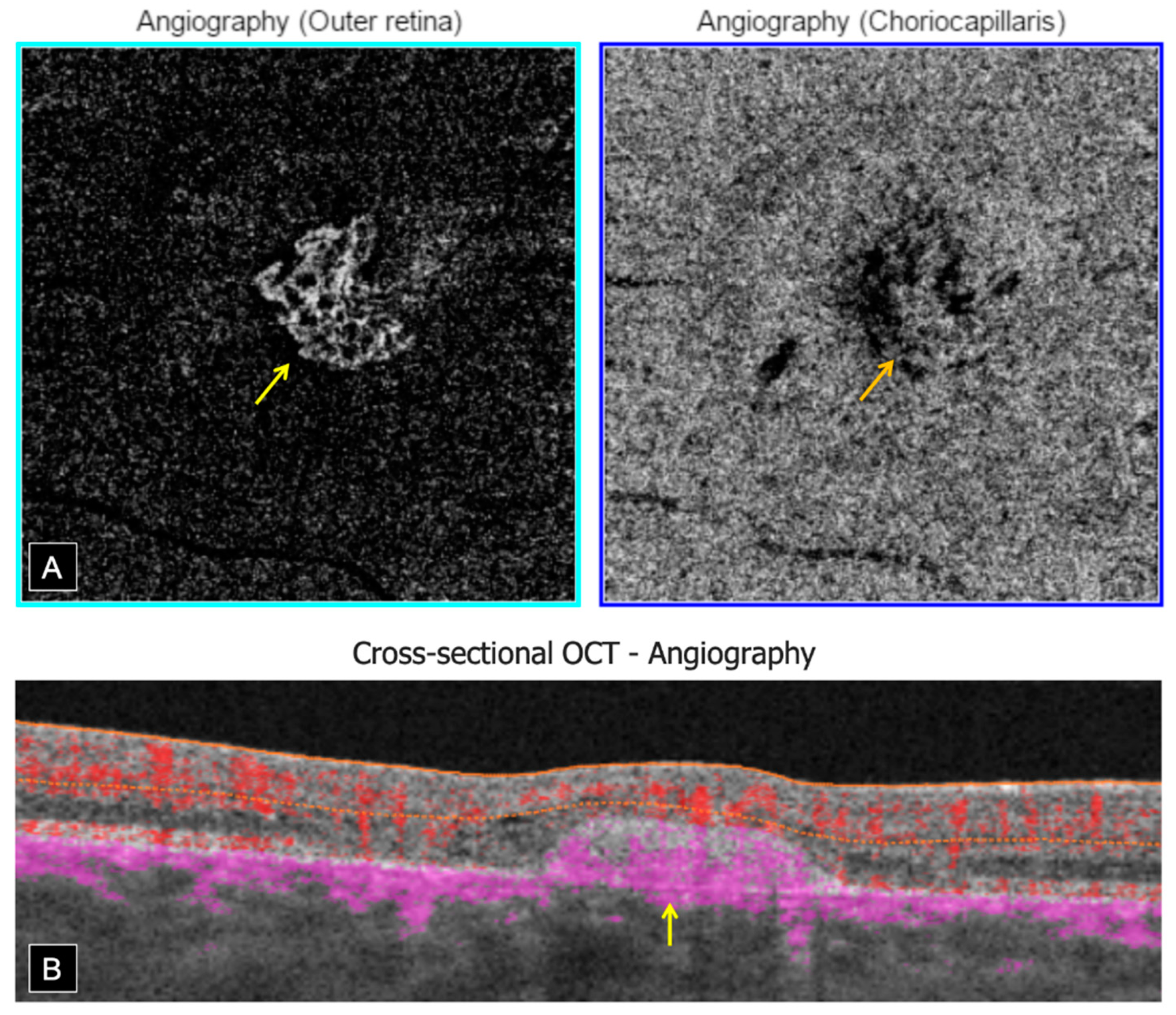 Genes 12 01795 g004 550
