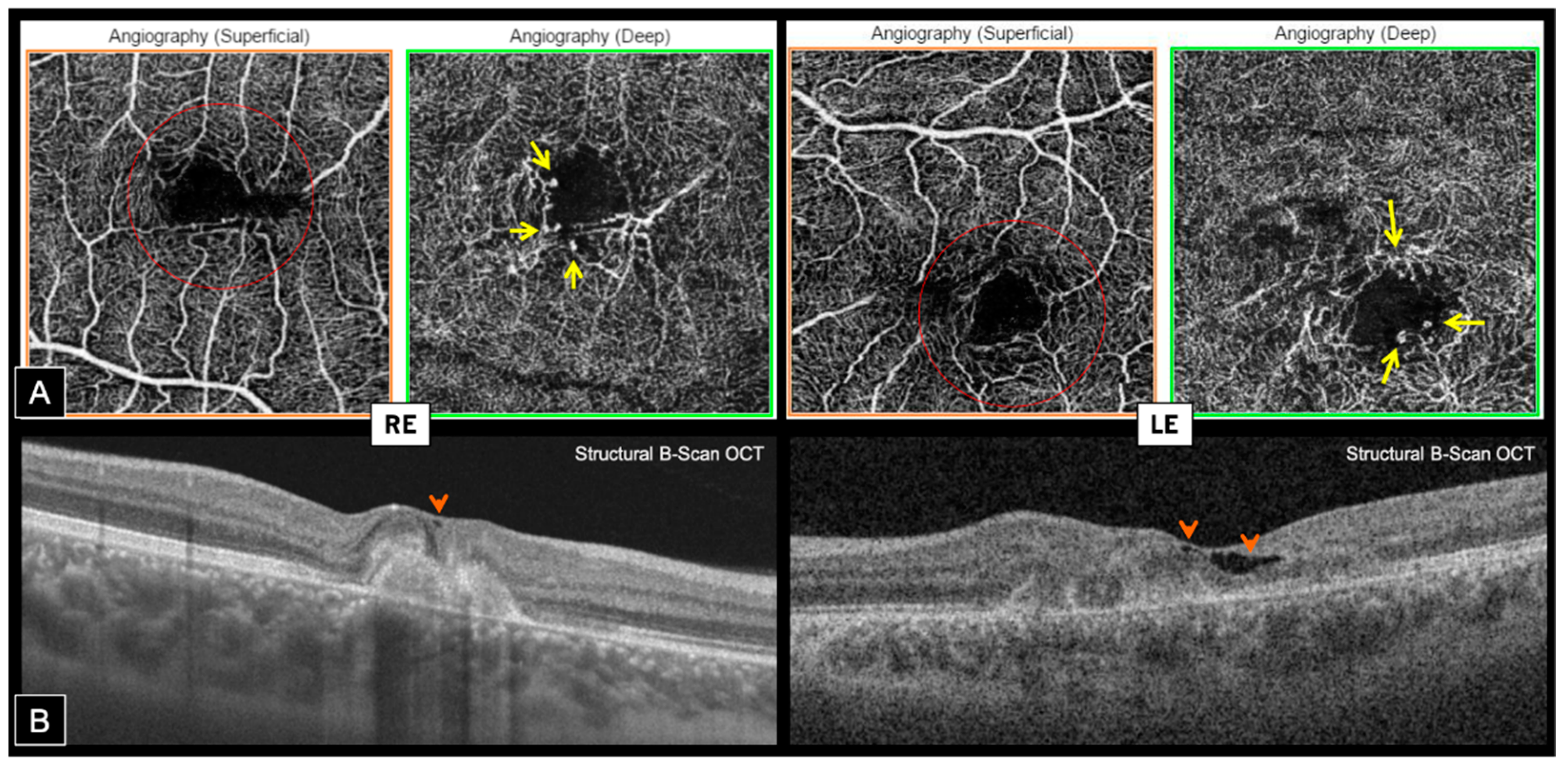 Genes 12 01795 g005 550