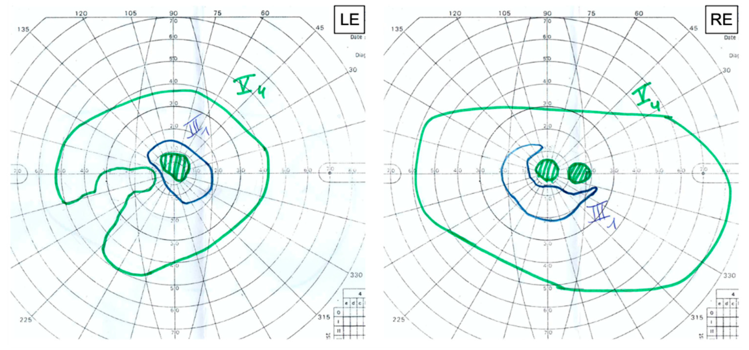 Genes 12 01795 g006 550