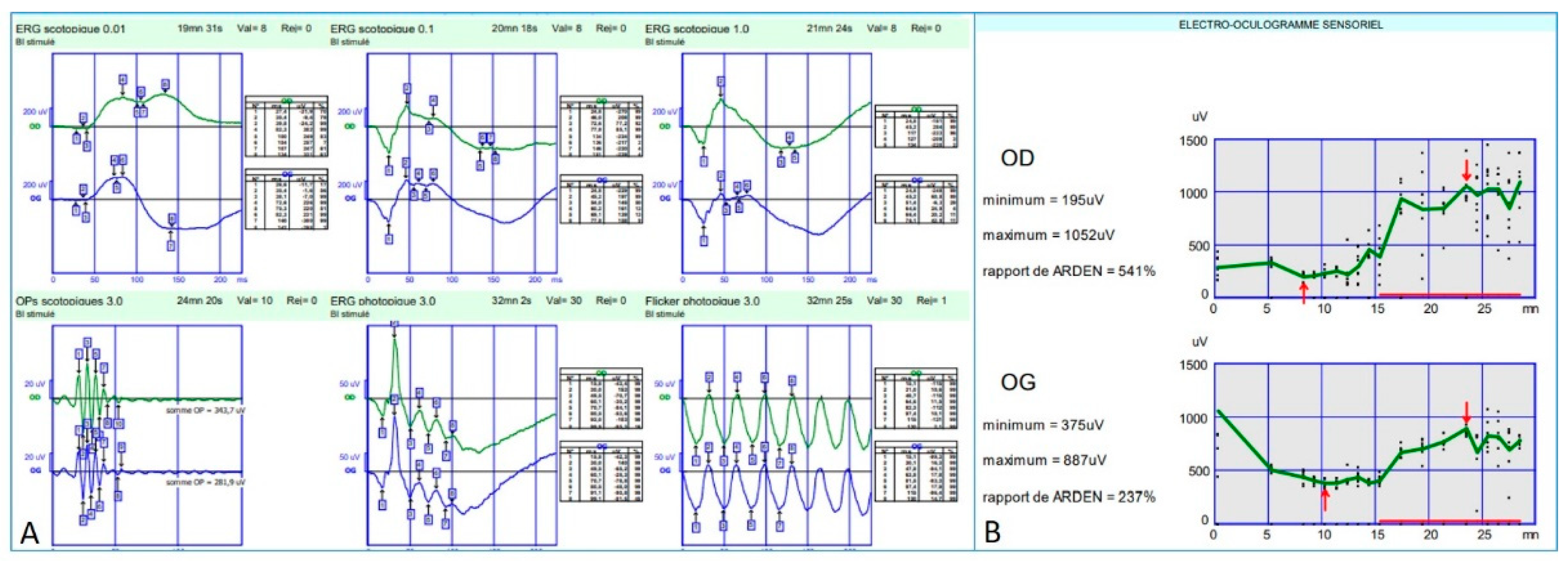 Genes 12 01795 g007 550