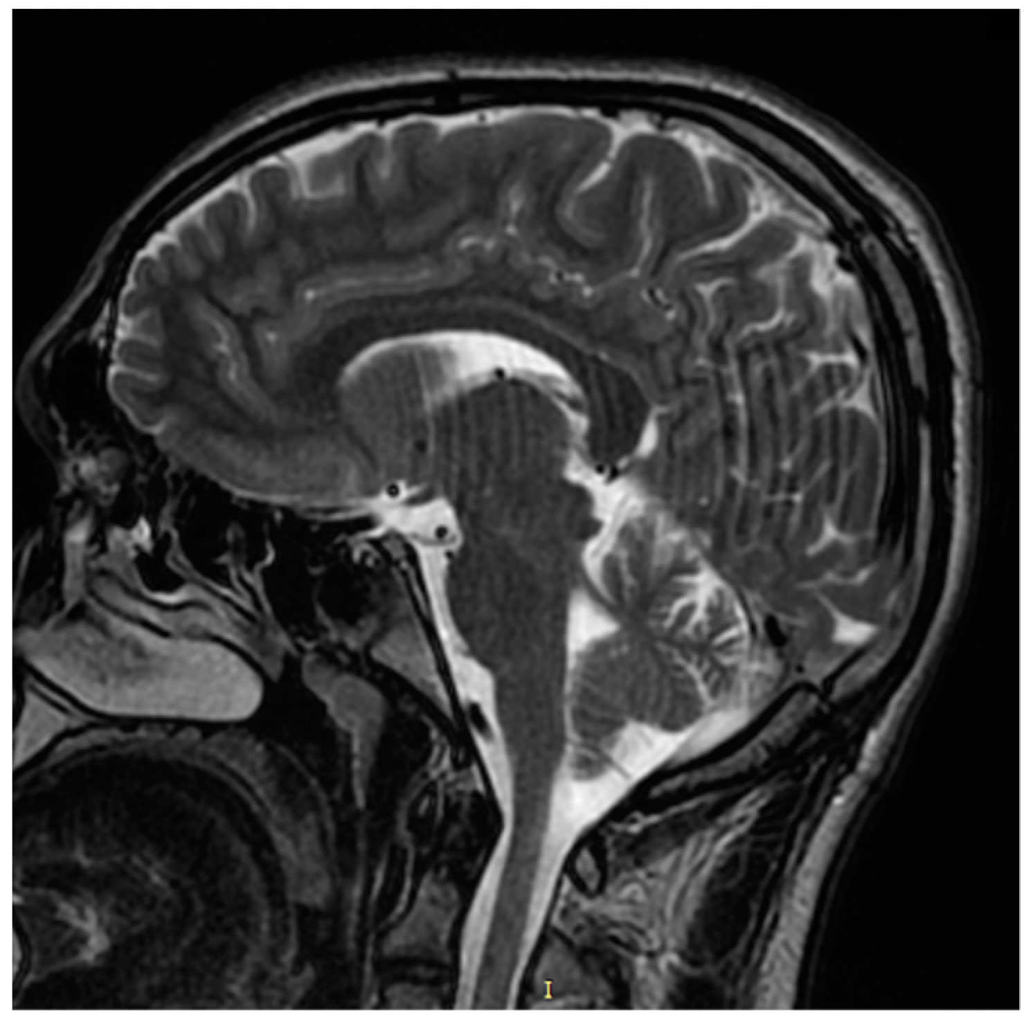 Genes 12 01795 g008 550