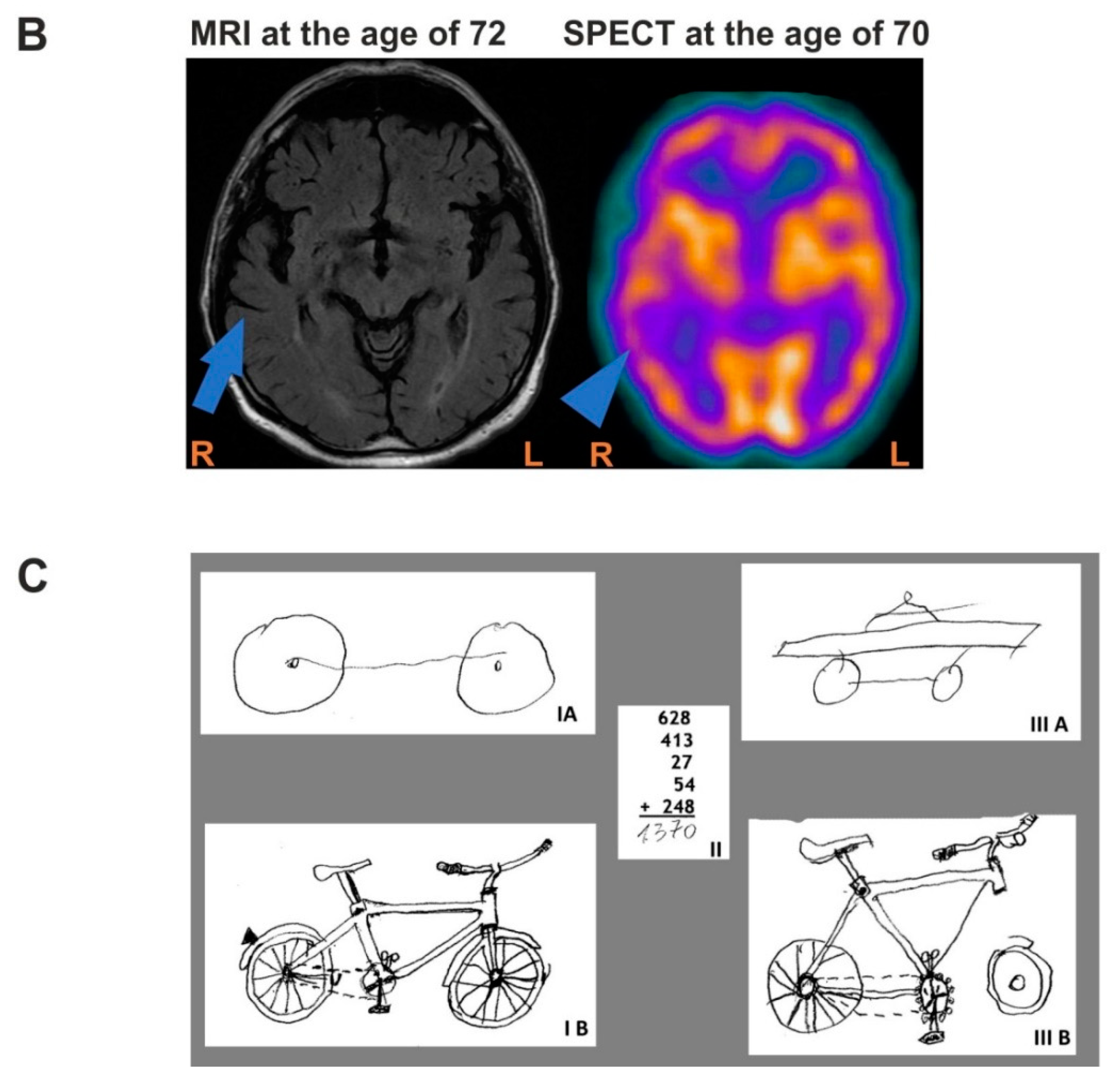 Genes 12 01806 g001b 550
