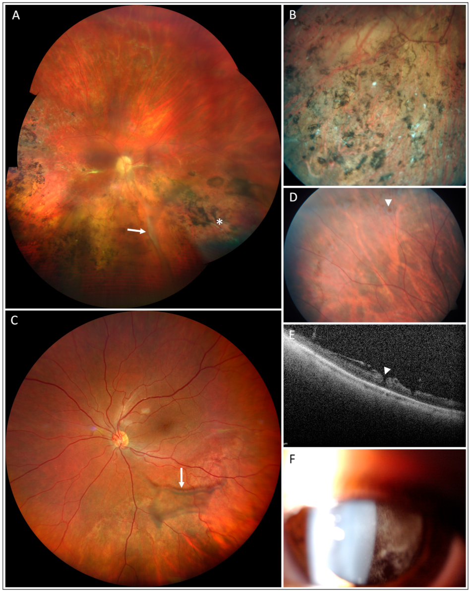Genes 12 01816 g001 Genes 12 01816 g001