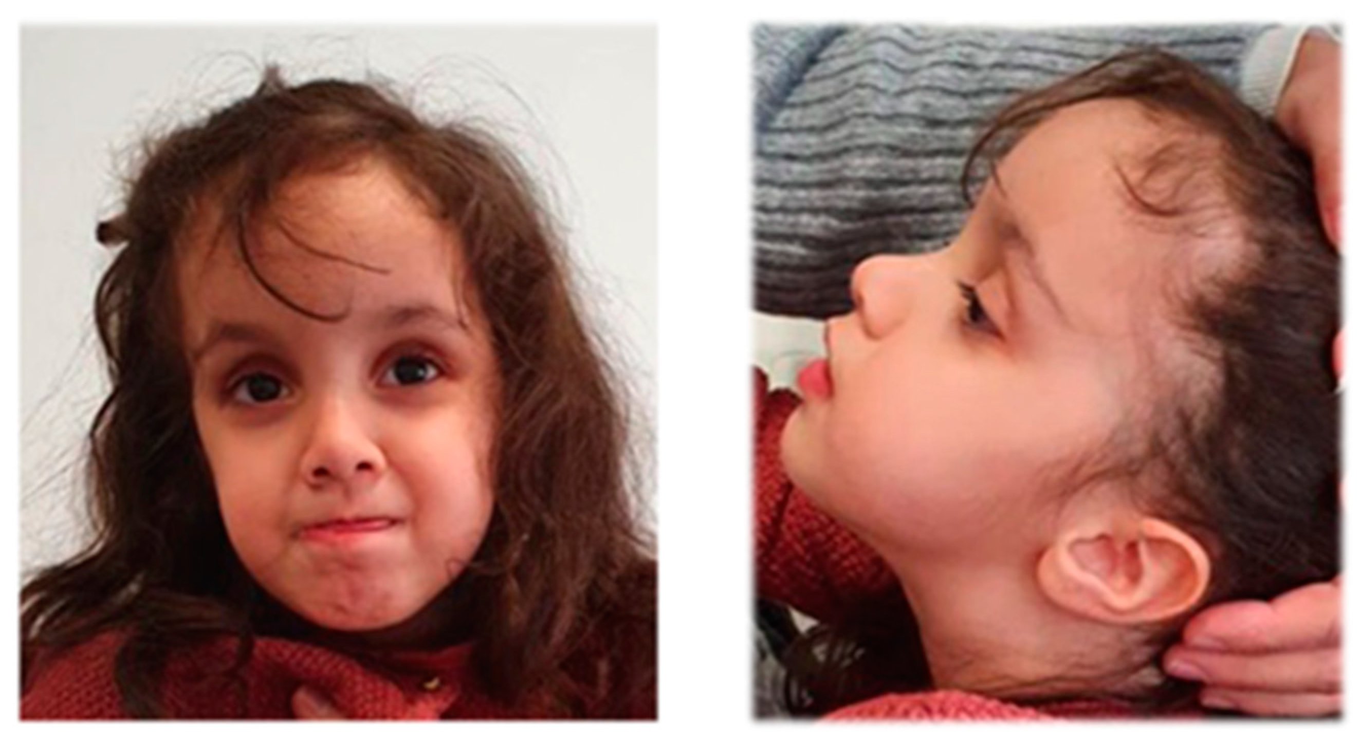 Genes 12 01909 g002 550