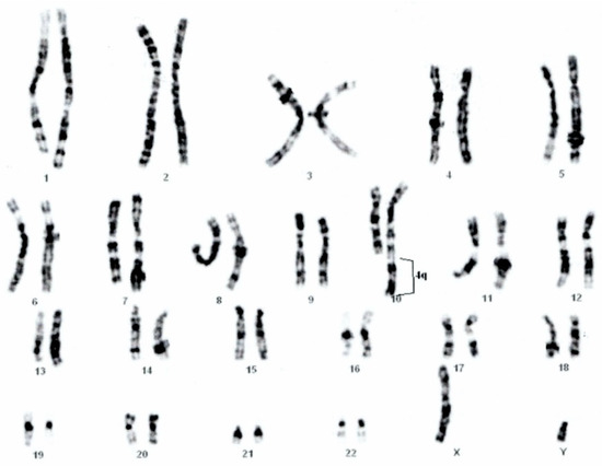 PDF] Ring Chromosome and Clinical Findings: Reports Cases of 4 Different  Chromosomes in Beninese Population | Semantic Scholar