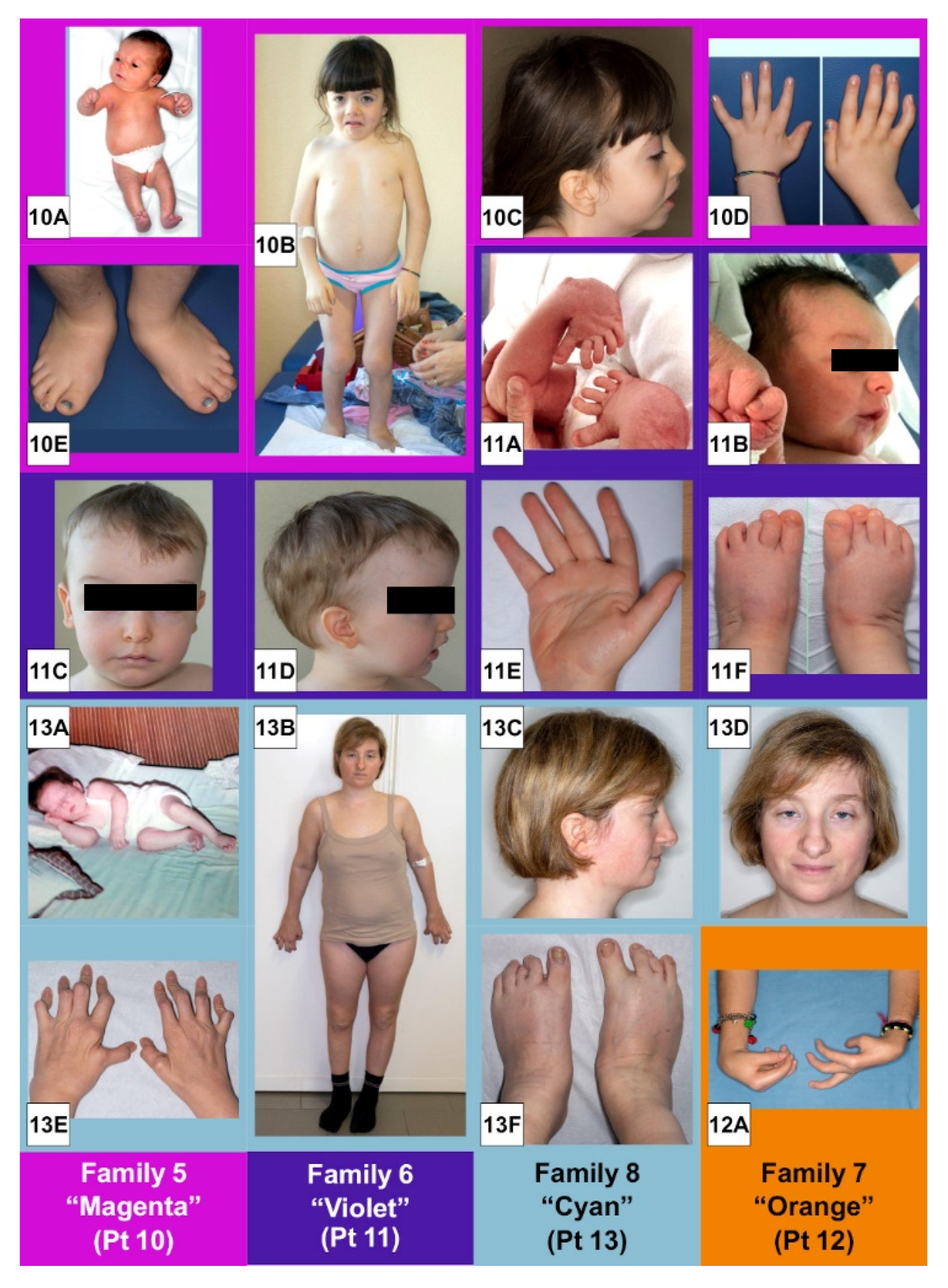 Genes 13 00029 g001c