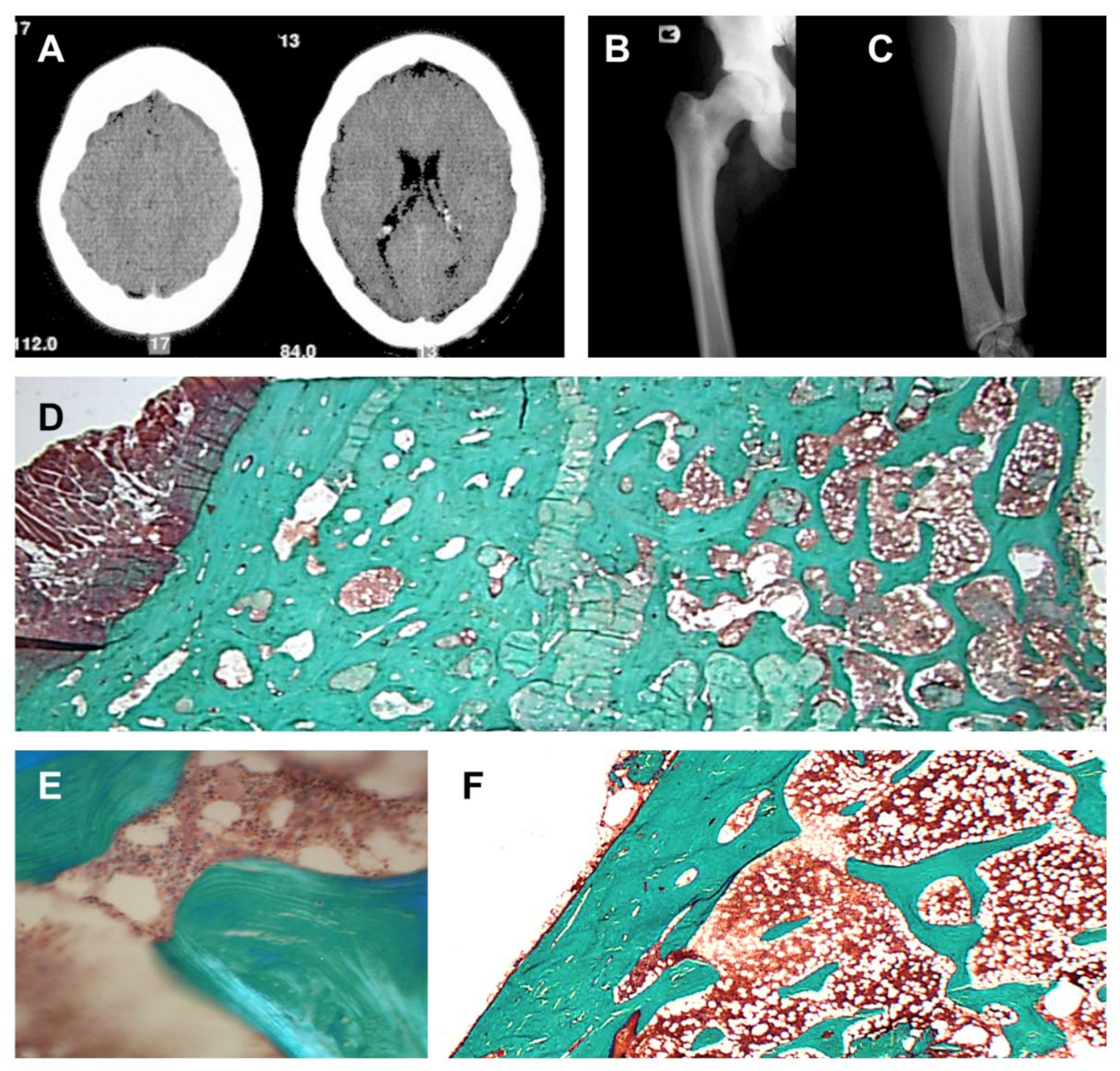 Genes 13 00080 g002 550