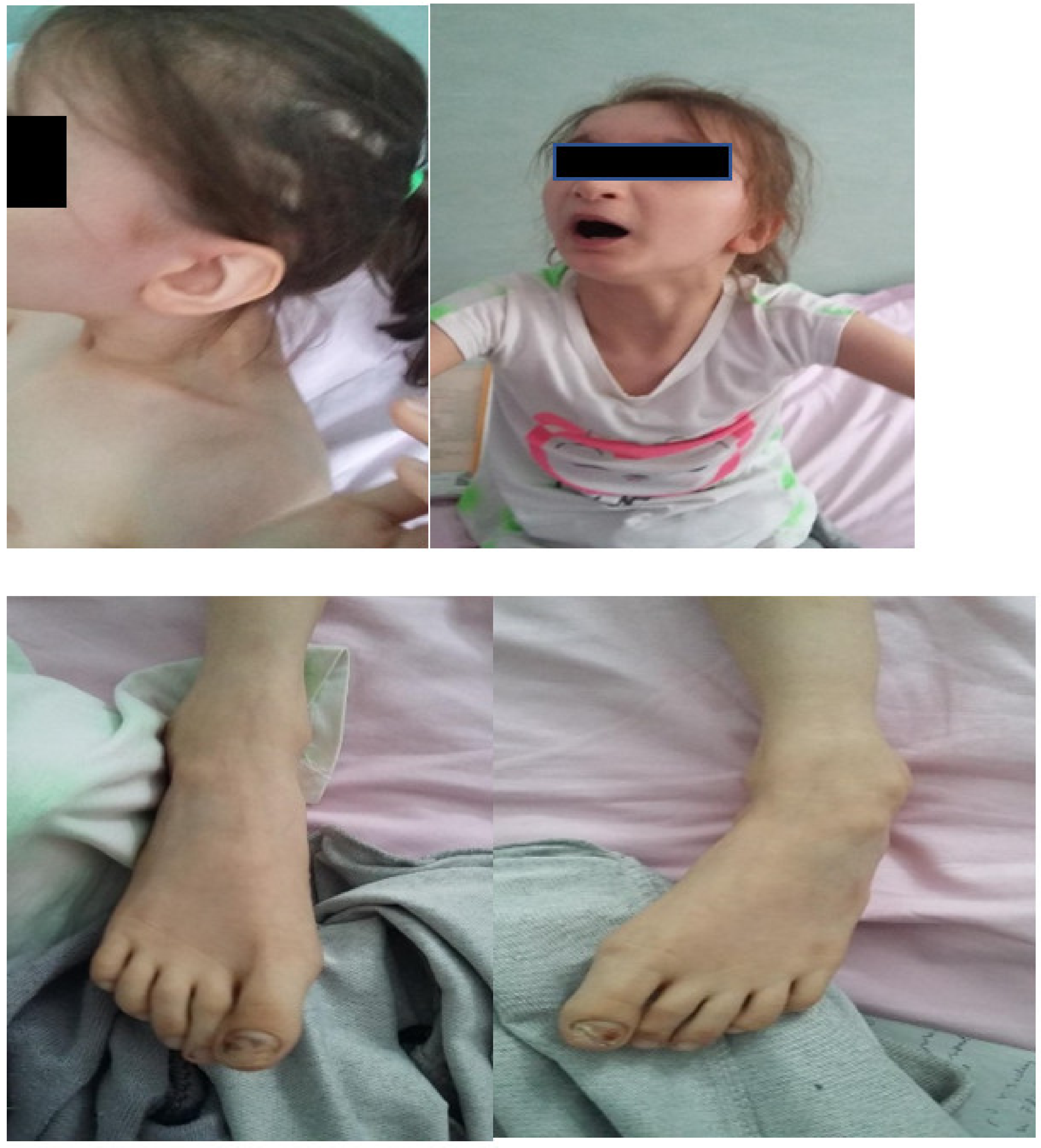 Genes 13 00212 g002 550