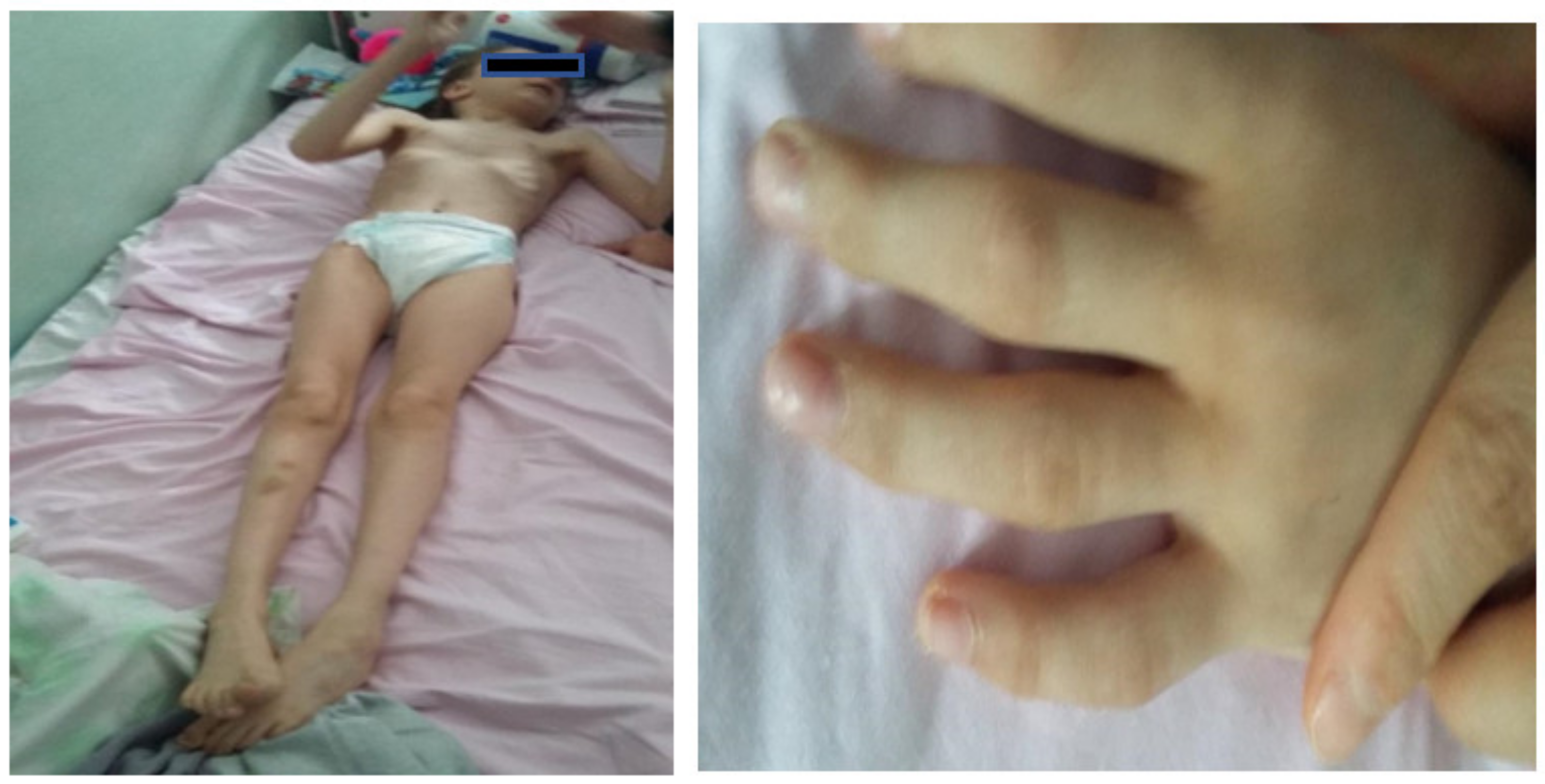 Genes 13 00212 g003 550