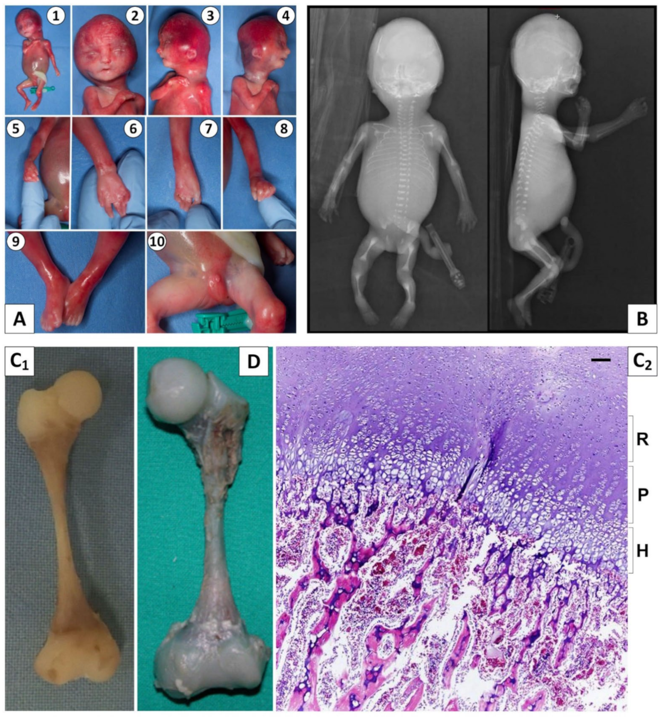 Genes 13 00261 g001 Genes 13 00261 g001