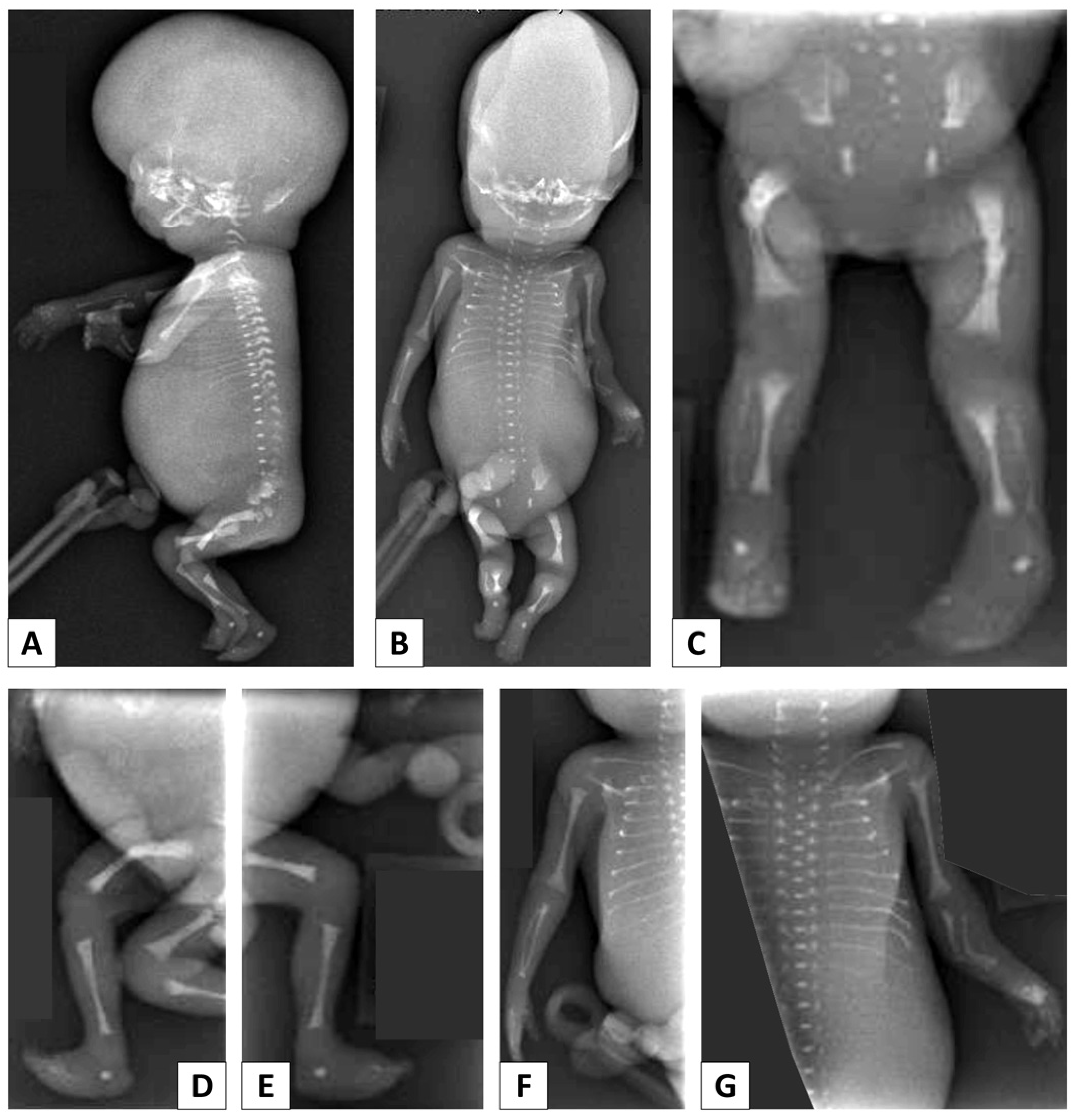 Genes 13 00261 g002 Genes 13 00261 g002